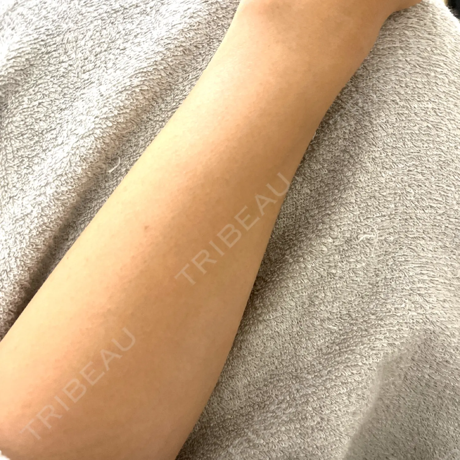 施術前の写真