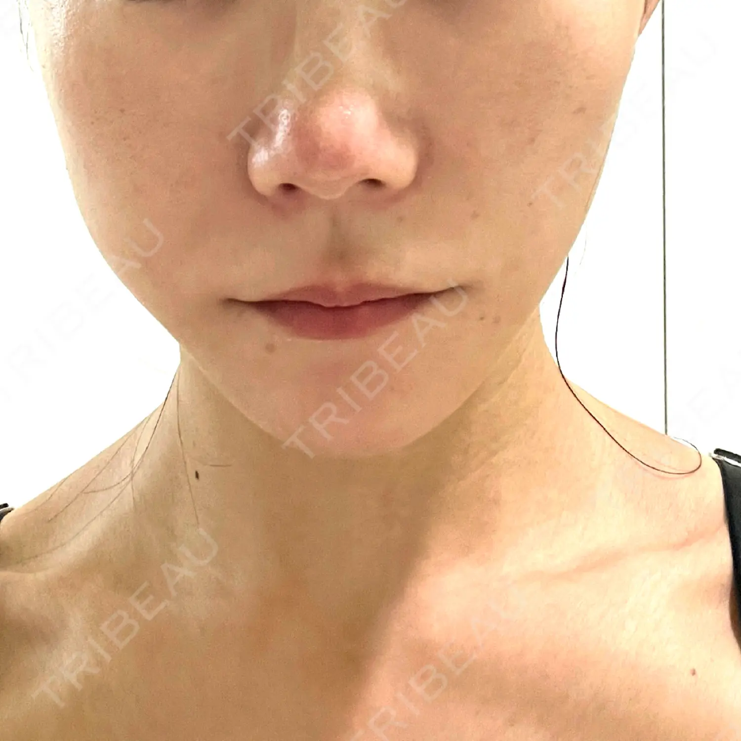 施術前の写真