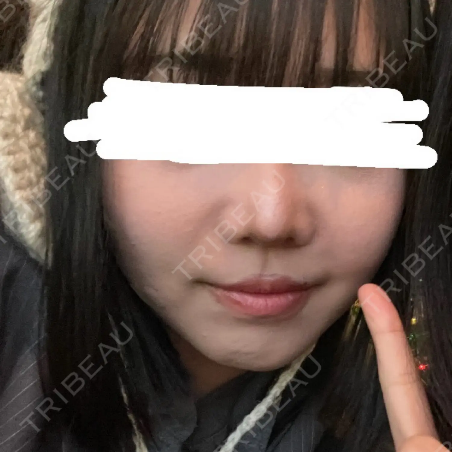 施術前の写真