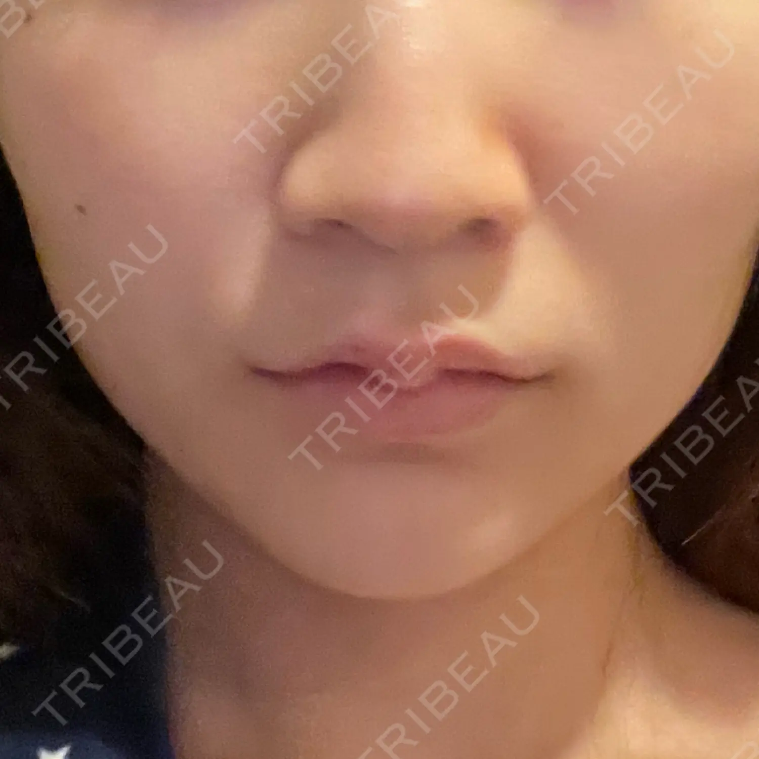 施術前の写真