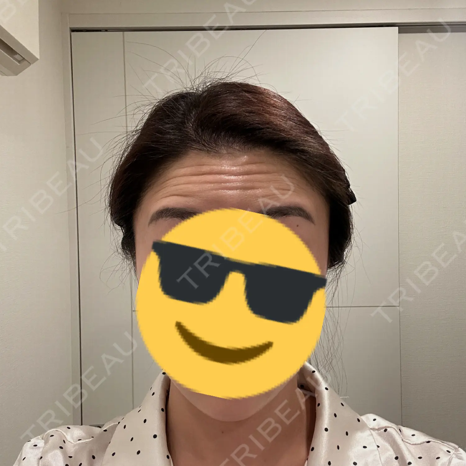 施術前の写真