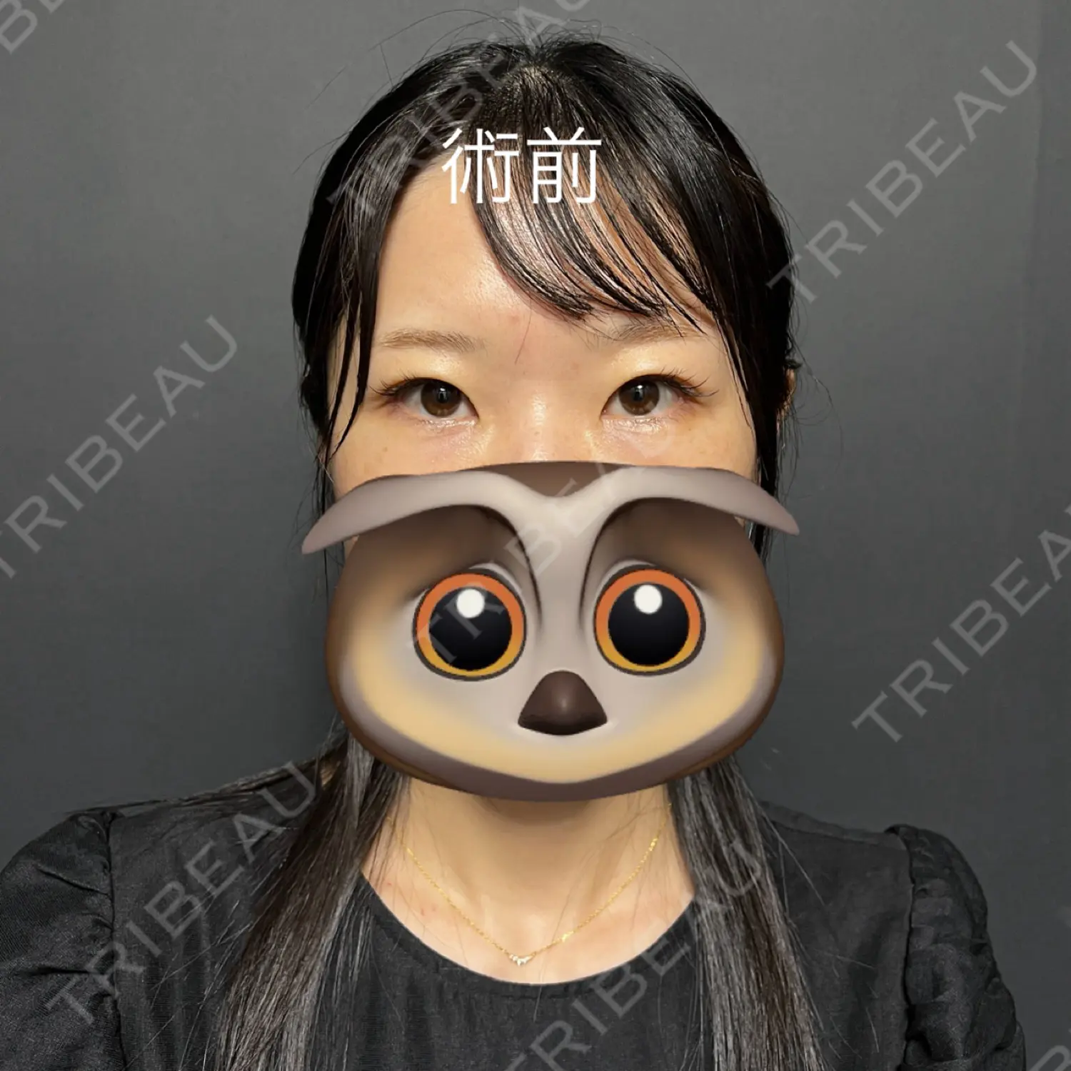 施術前の写真