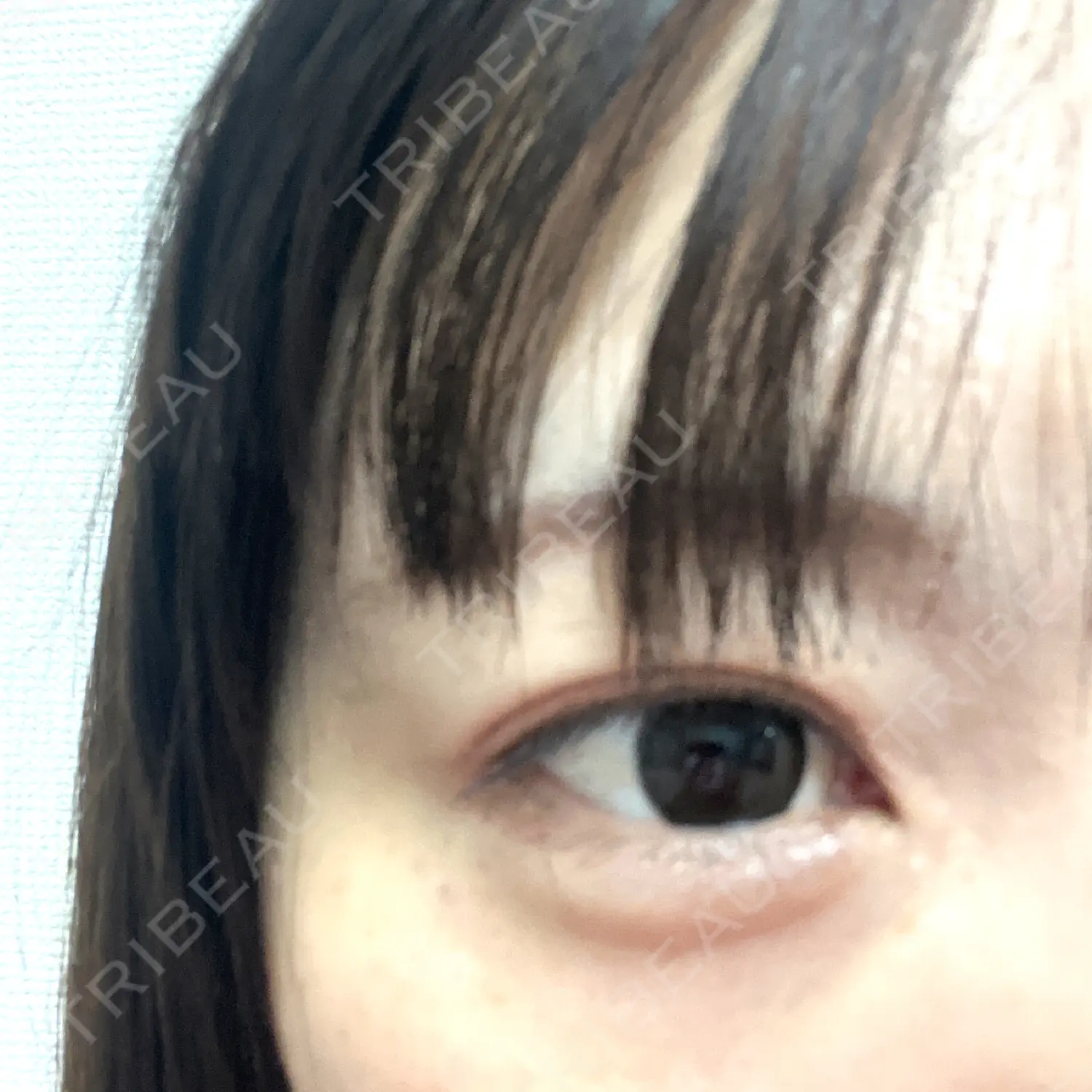 施術前の写真
