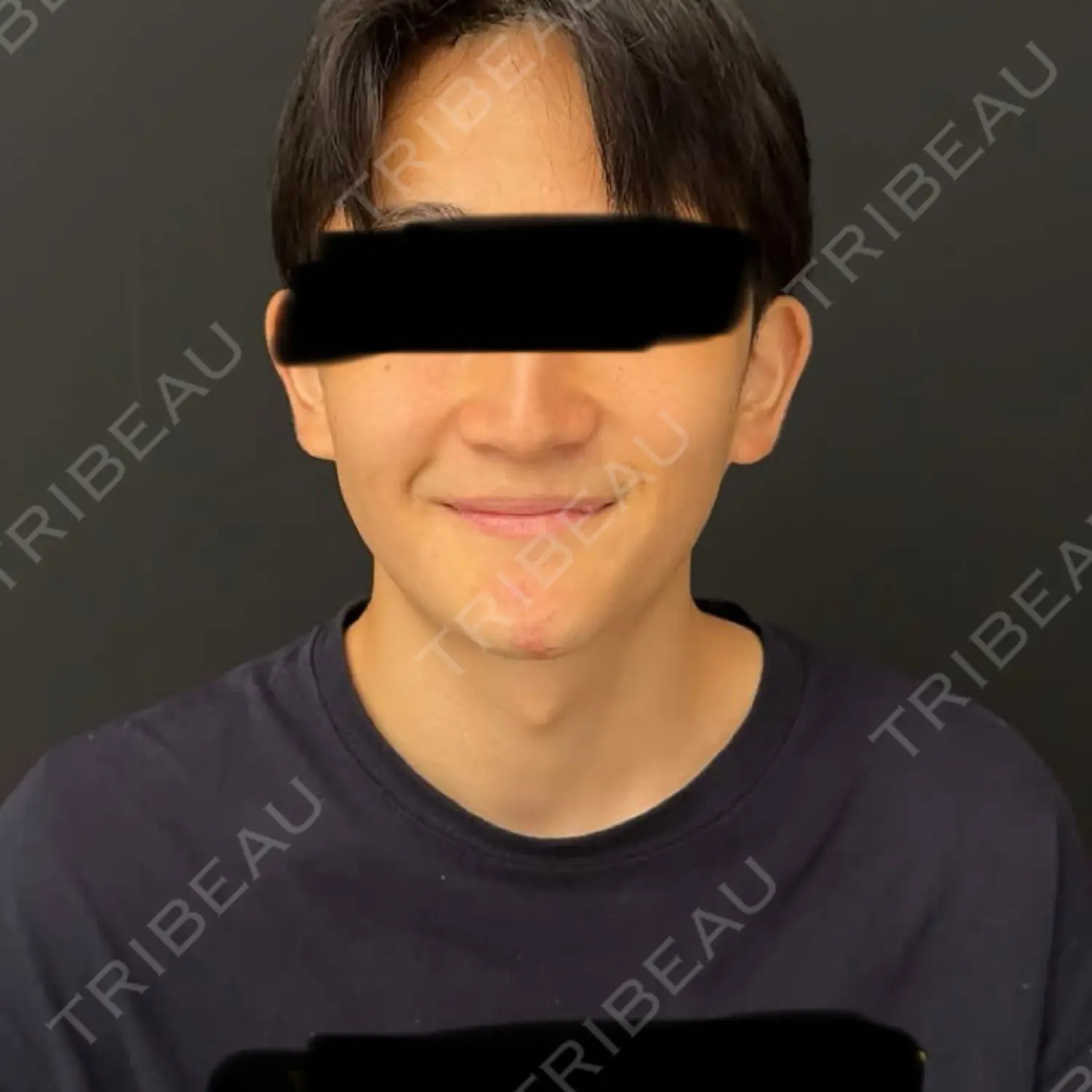 施術前の写真