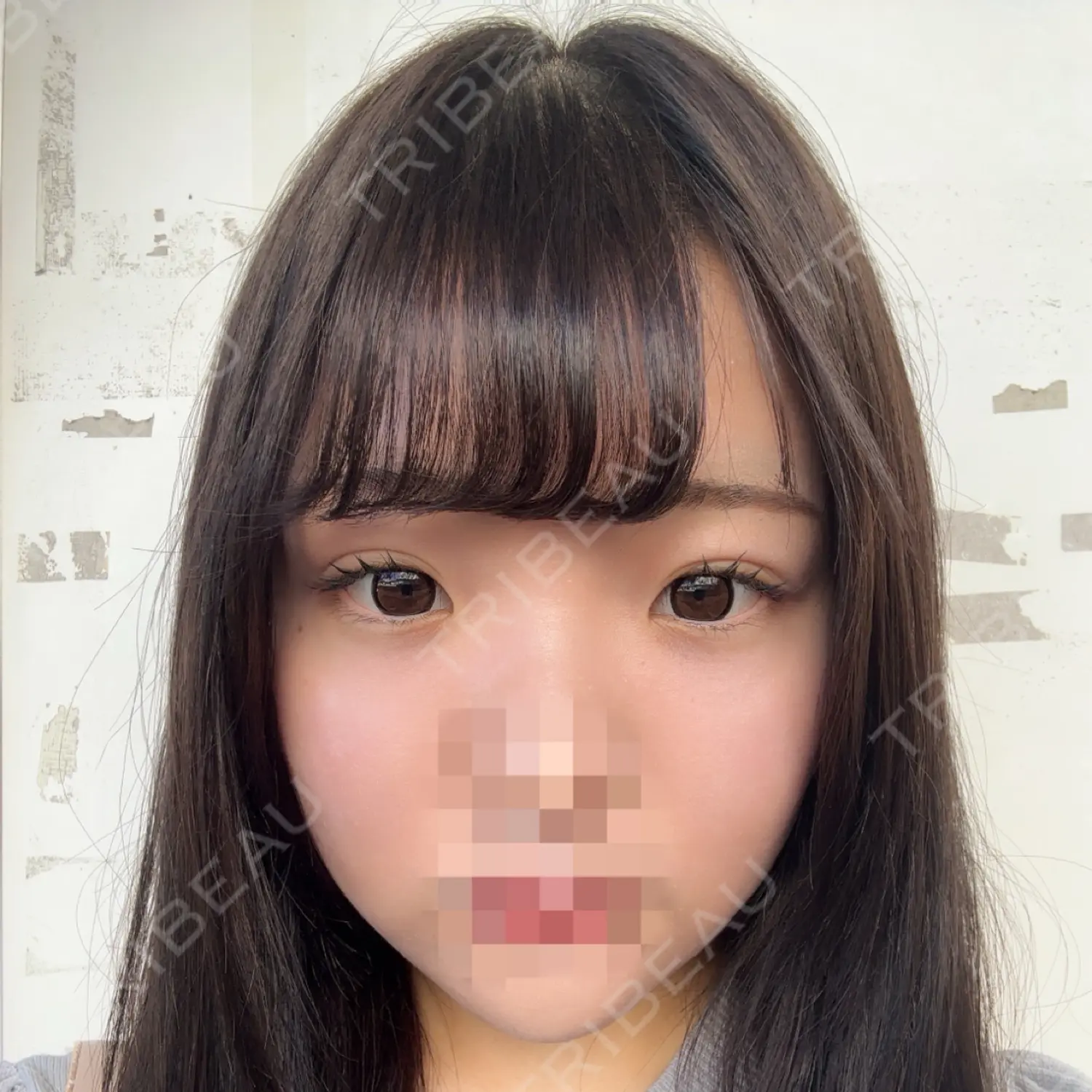 施術前の写真