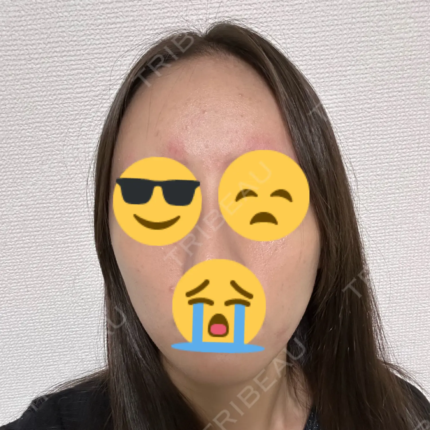 施術前の写真