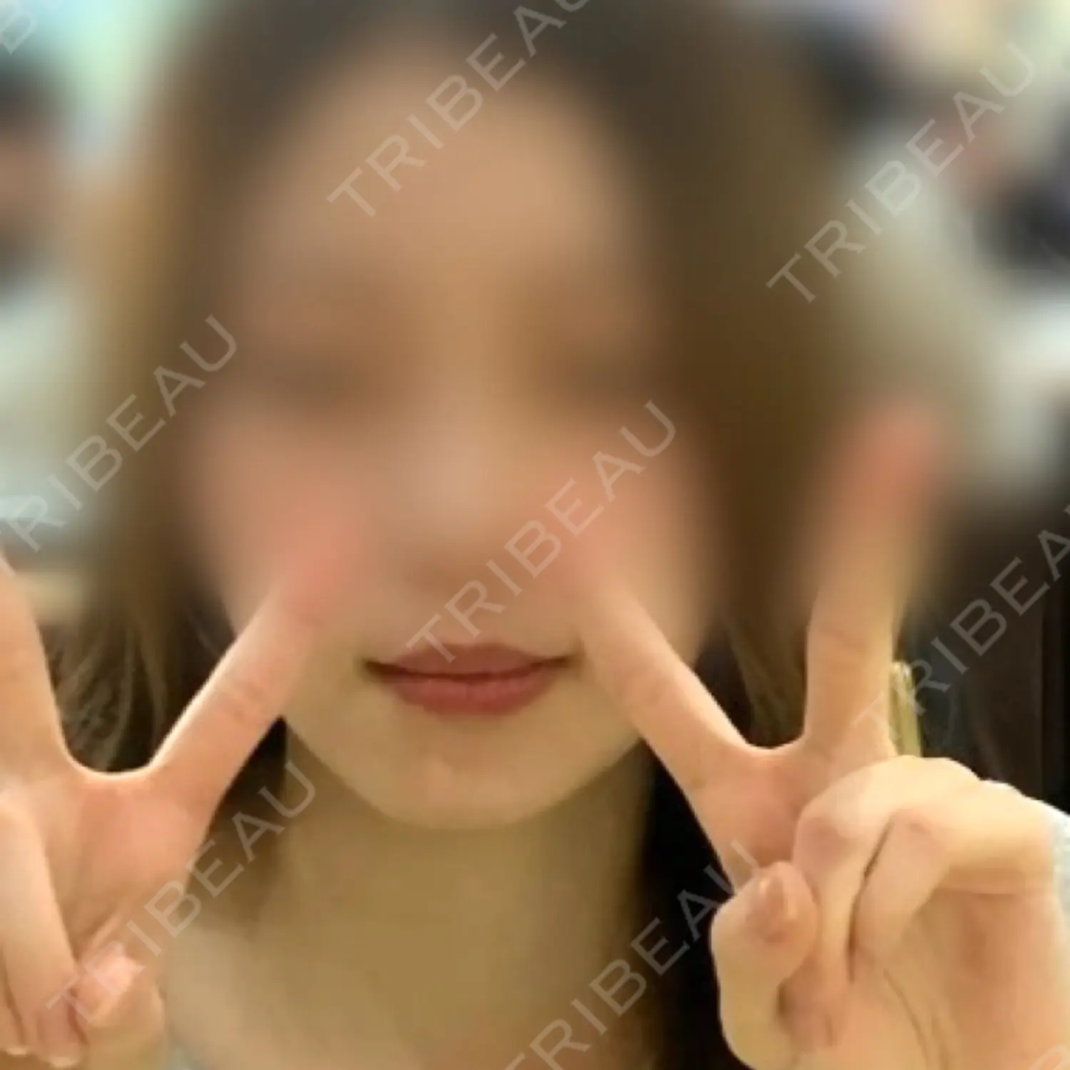 施術前の写真