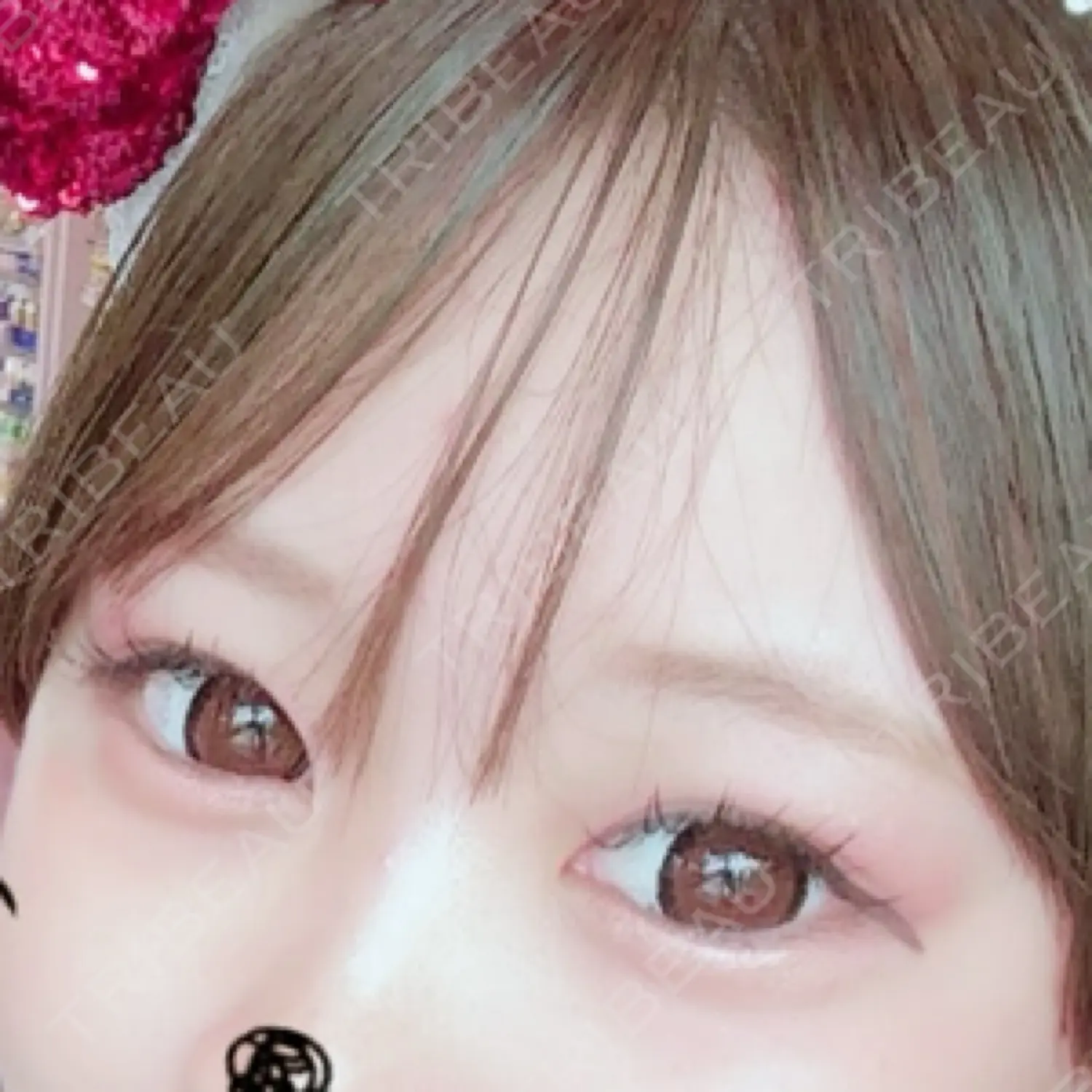 施術前の写真