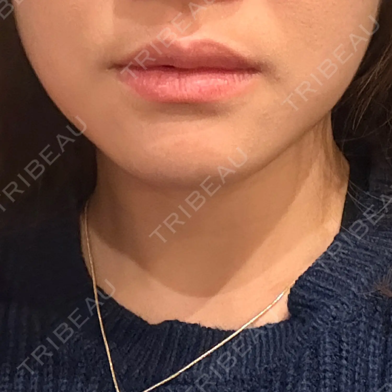 施術前の写真