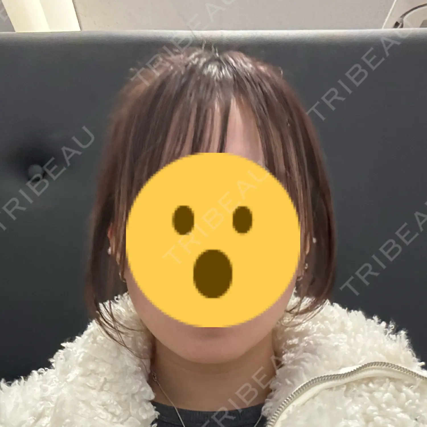 施術前の写真
