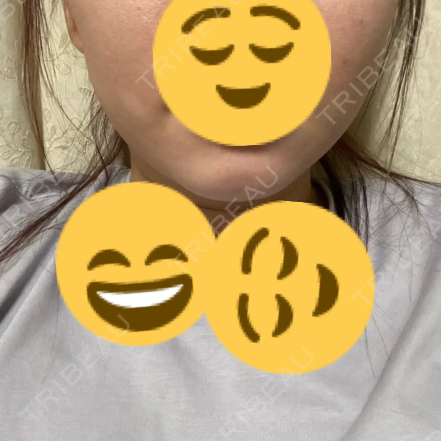 施術前の写真