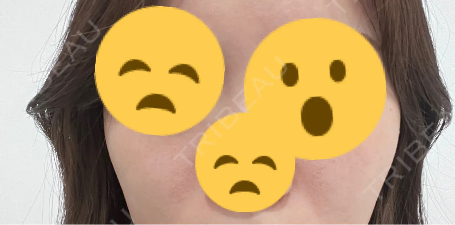 施術前の写真