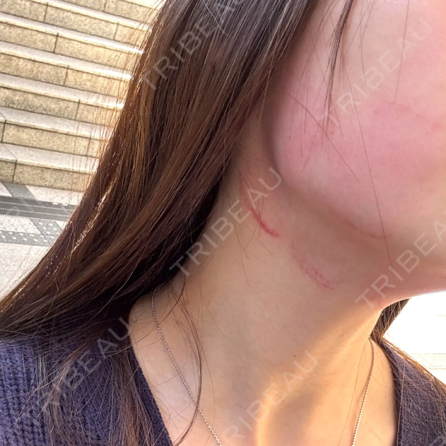 施術前の写真