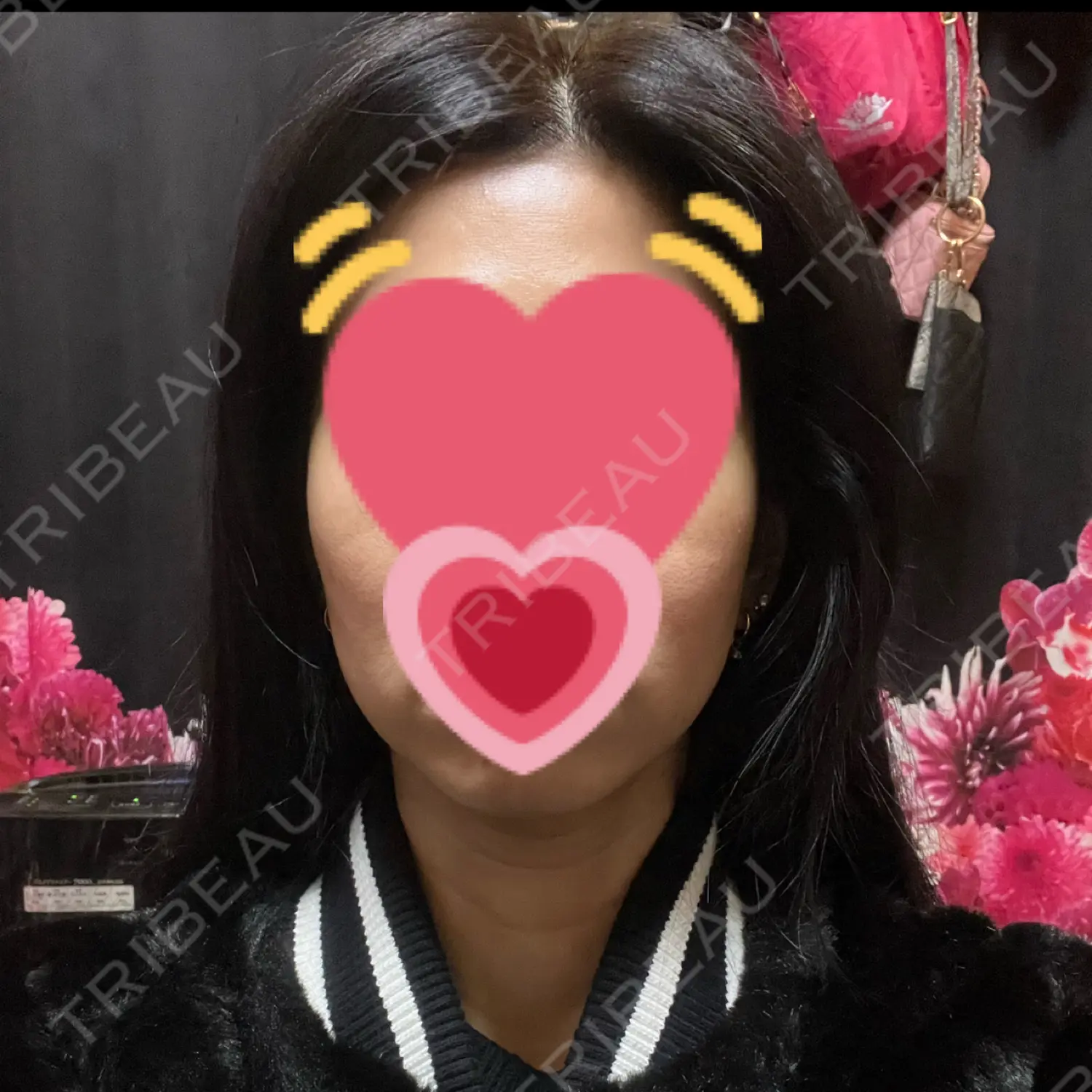 施術前の写真