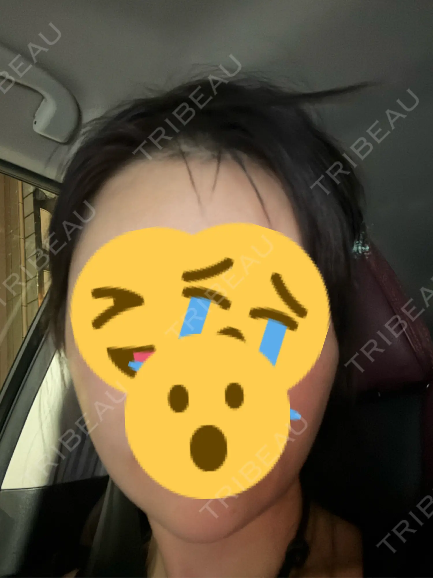 施術前の写真