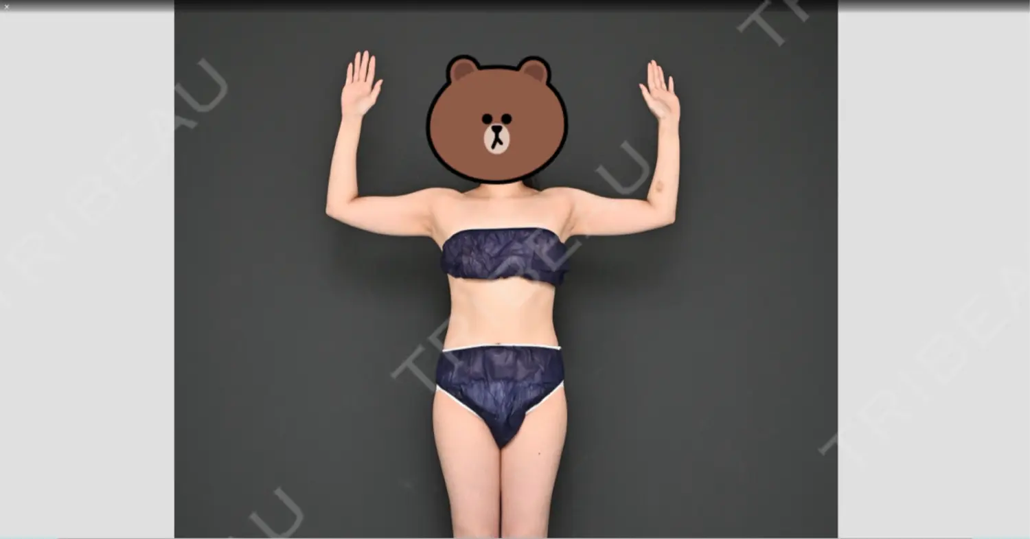 施術前の写真