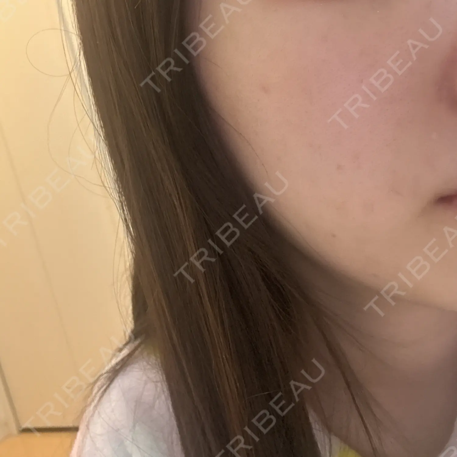 施術前の写真
