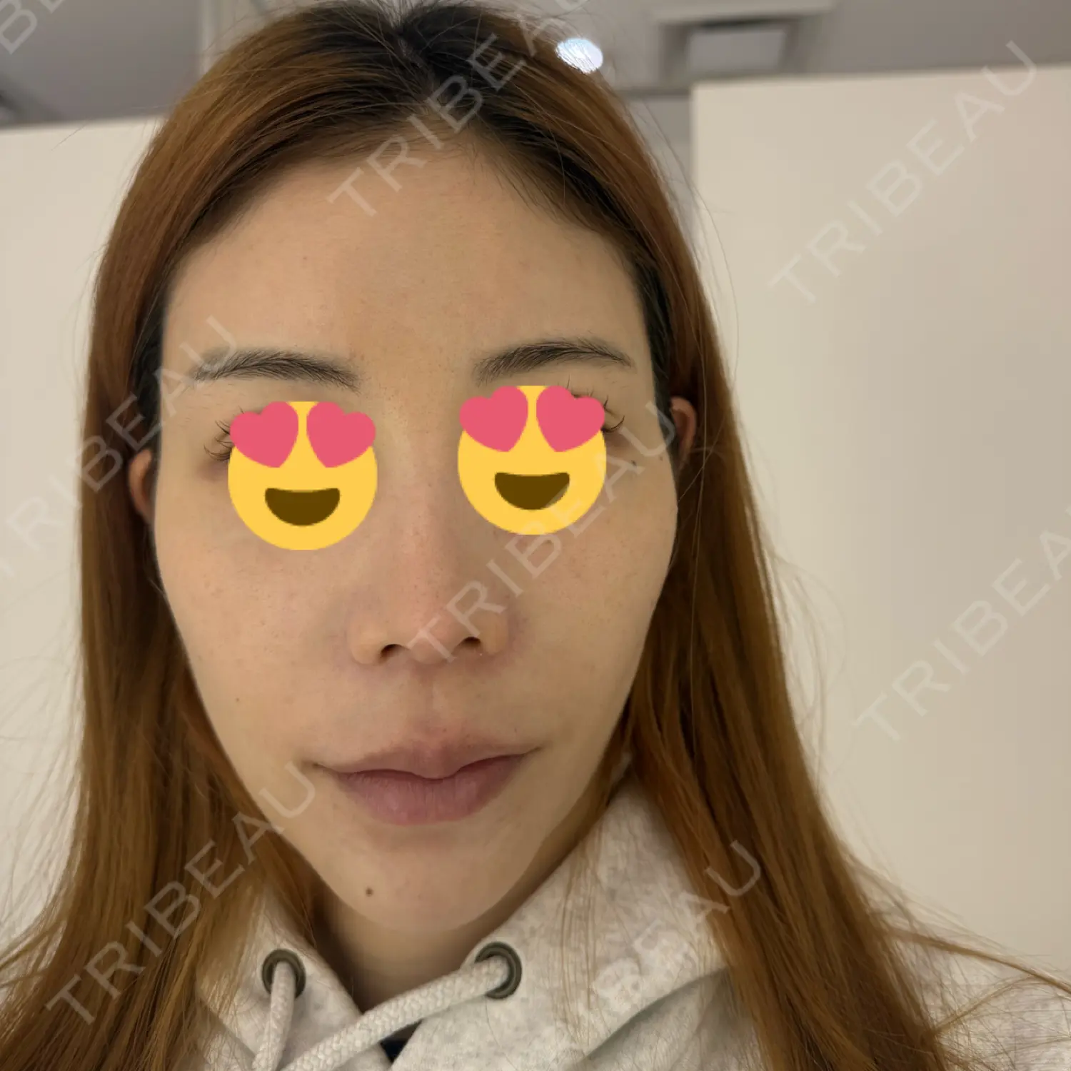 施術前の写真