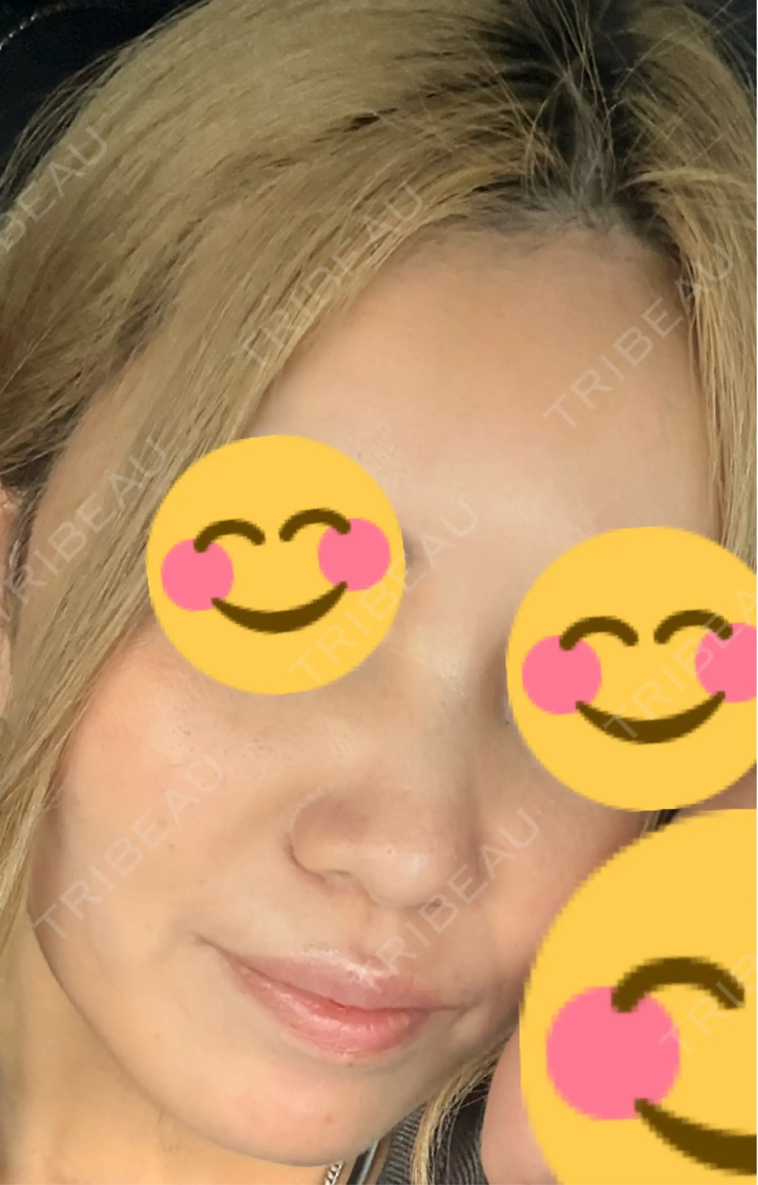 施術前の写真