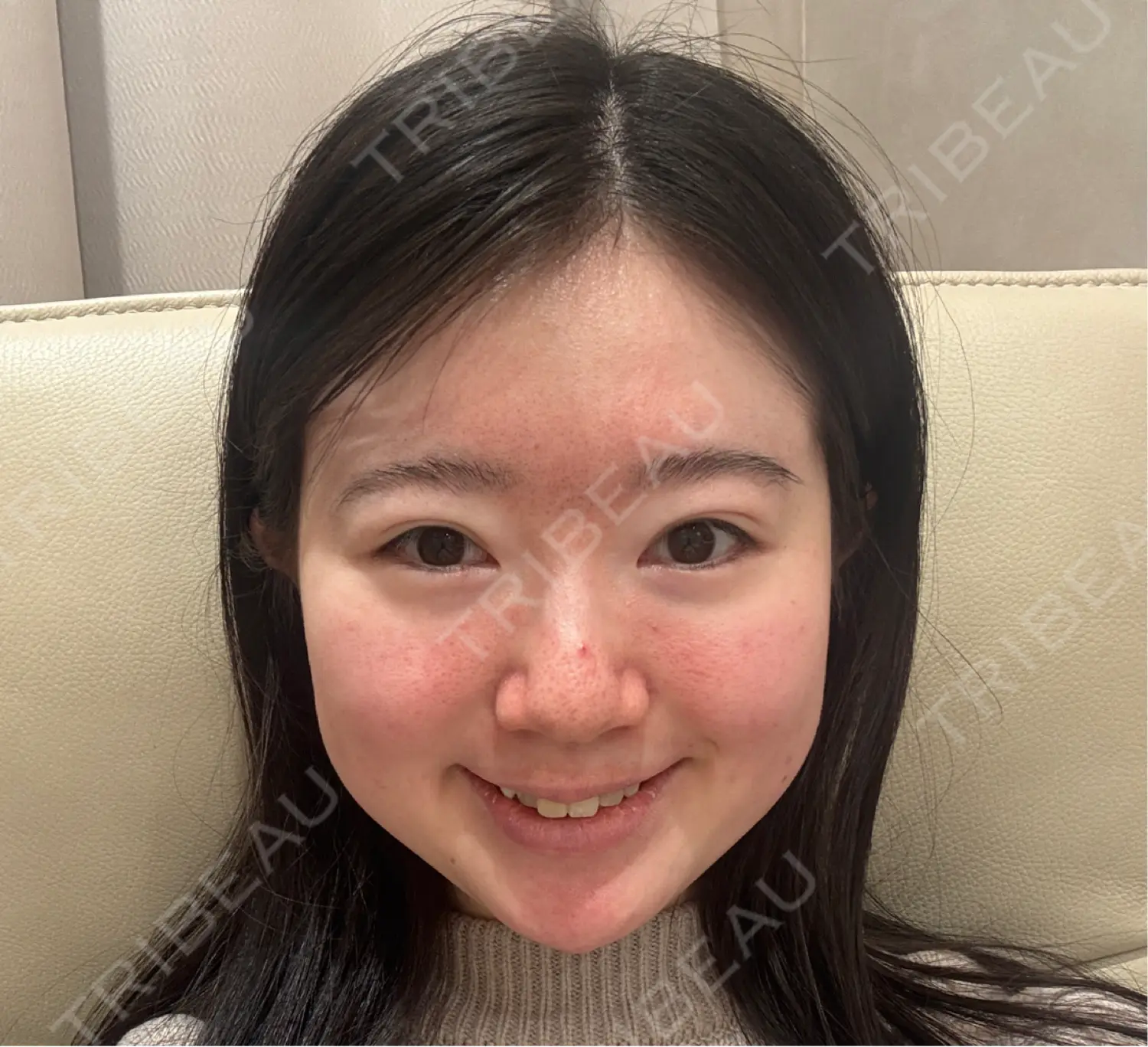 施術前の写真