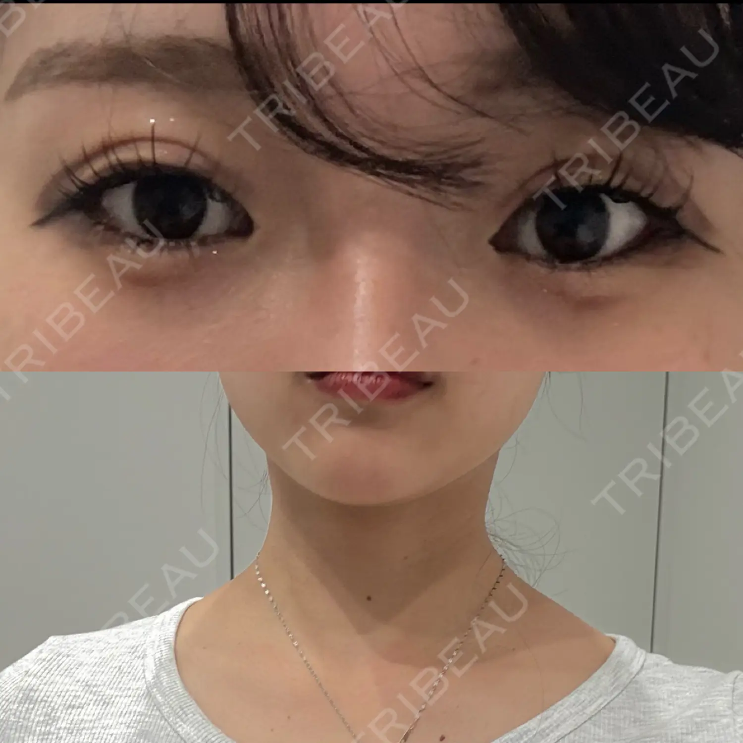 施術前の写真