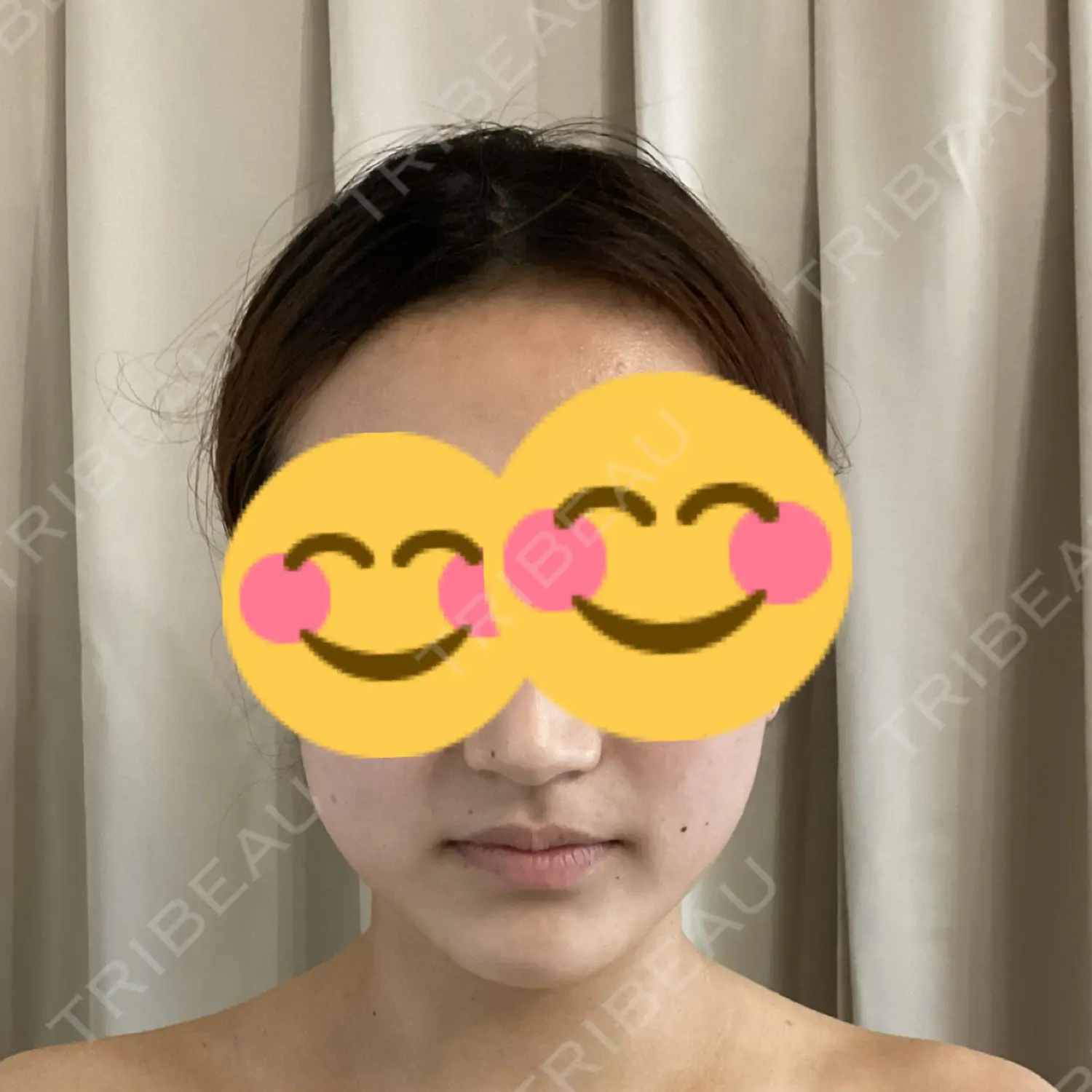 施術前の写真