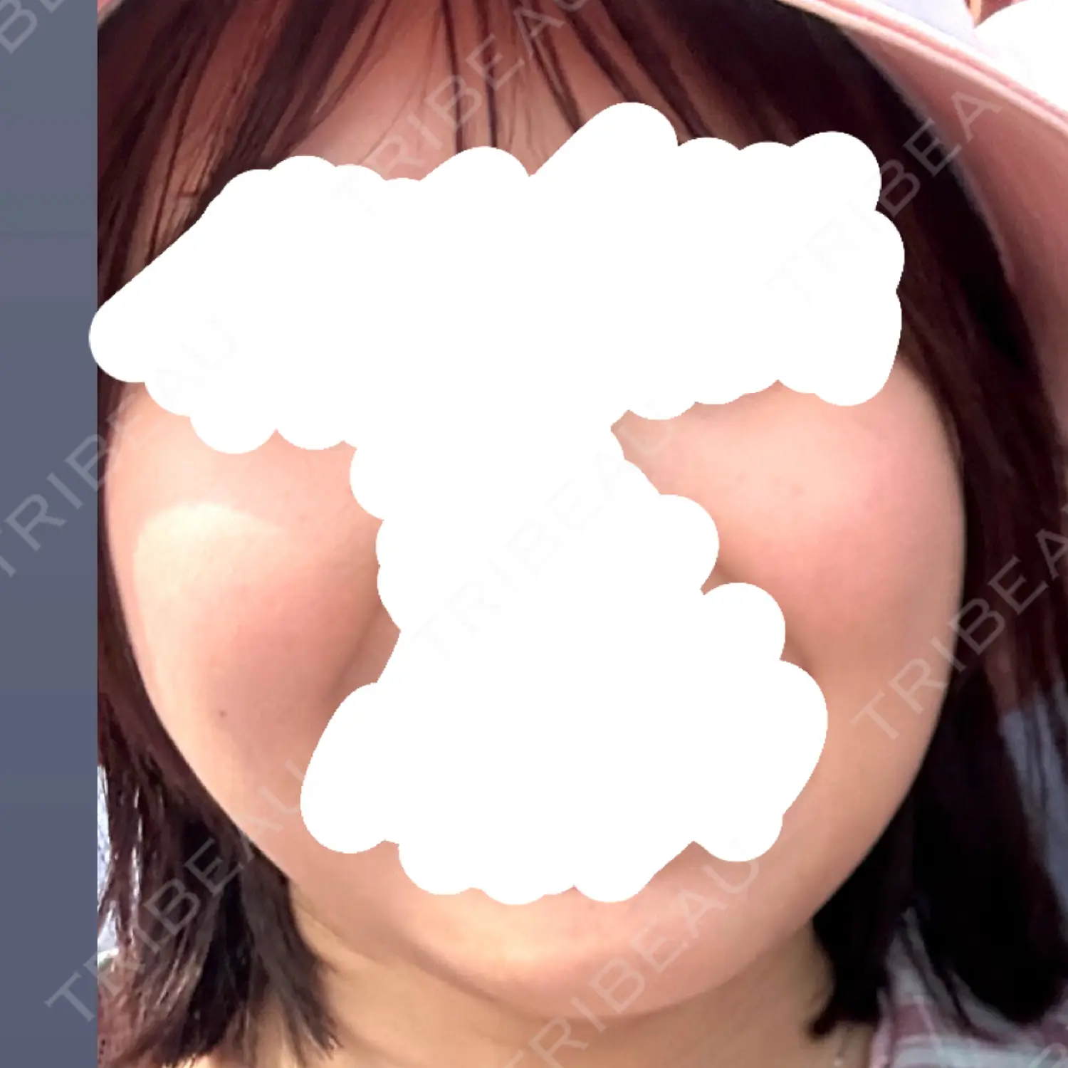 施術前の写真