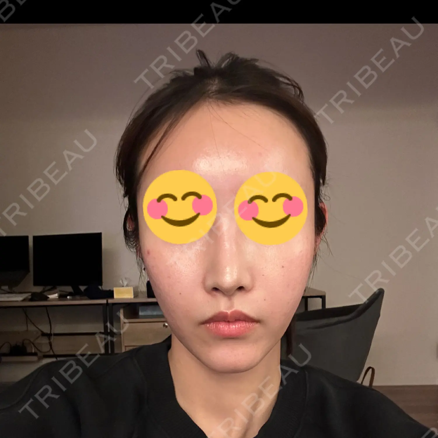 施術前の写真