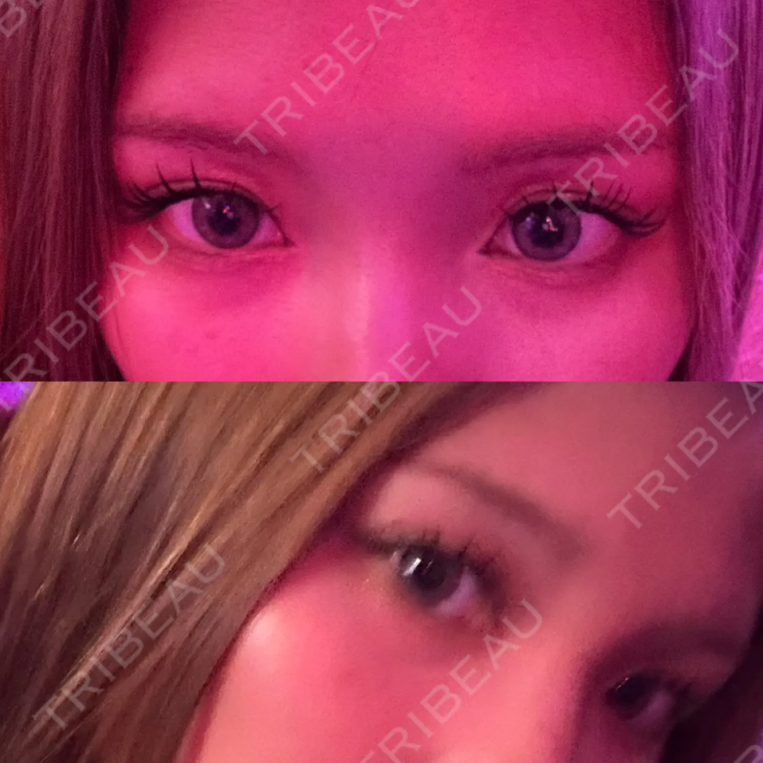 施術前の写真