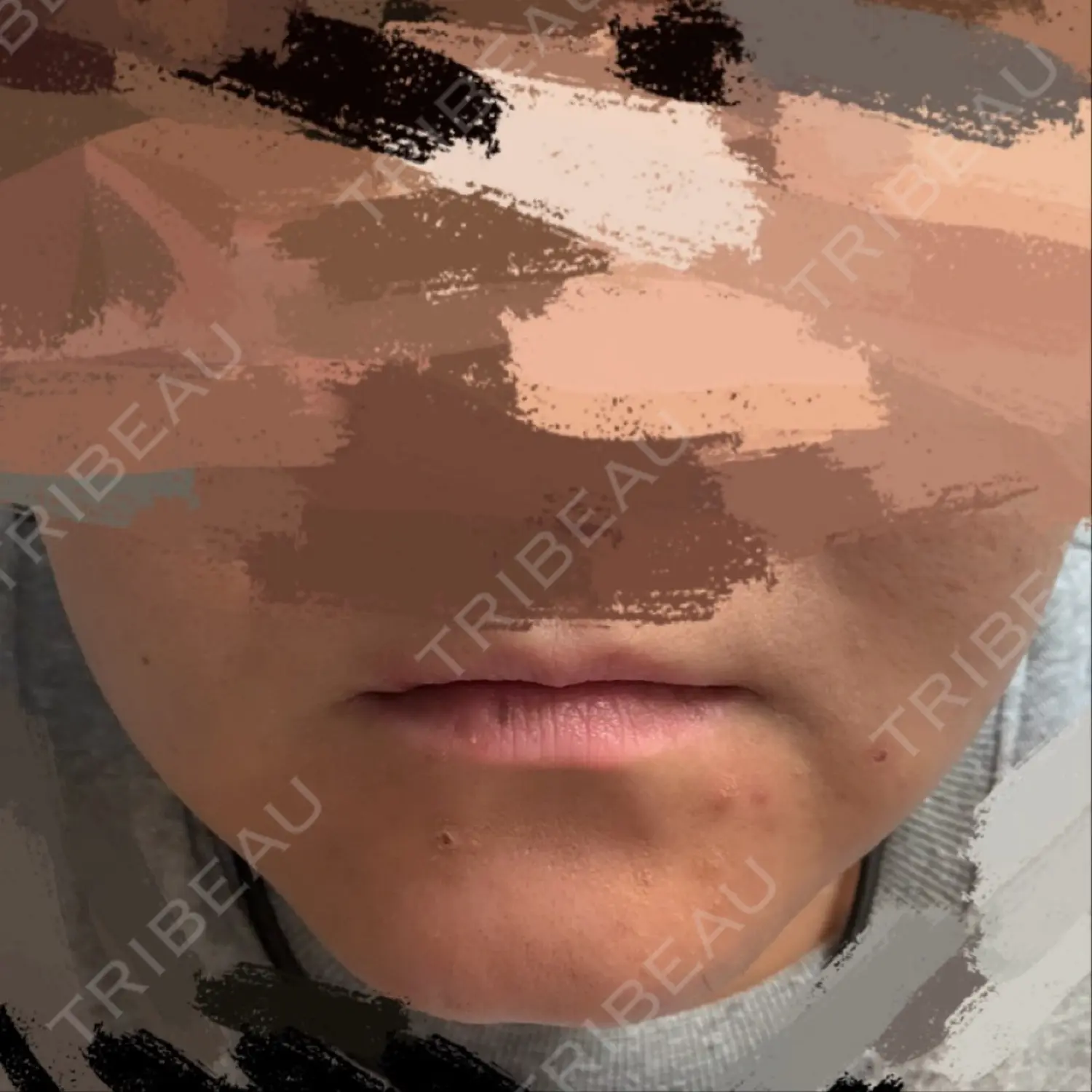 施術前の写真