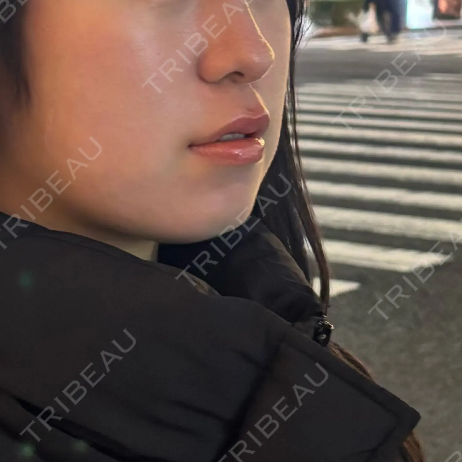 施術前の写真