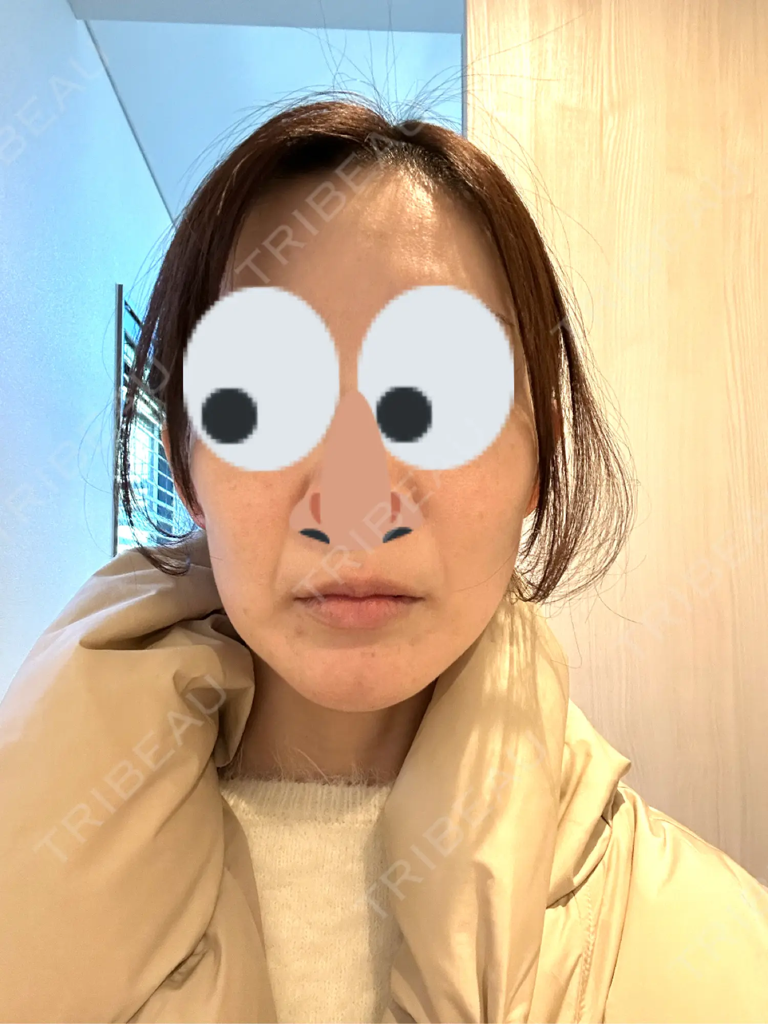 施術前の写真
