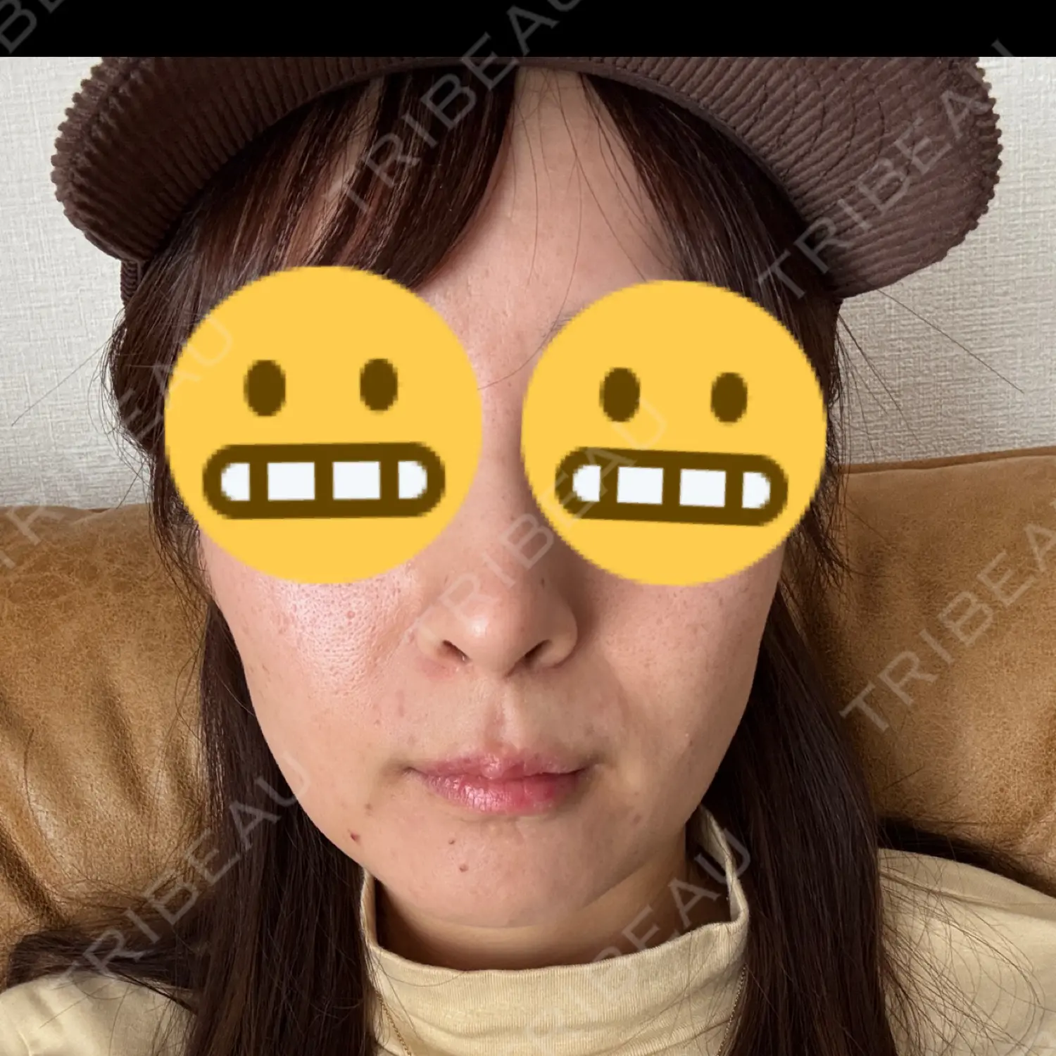 施術前の写真