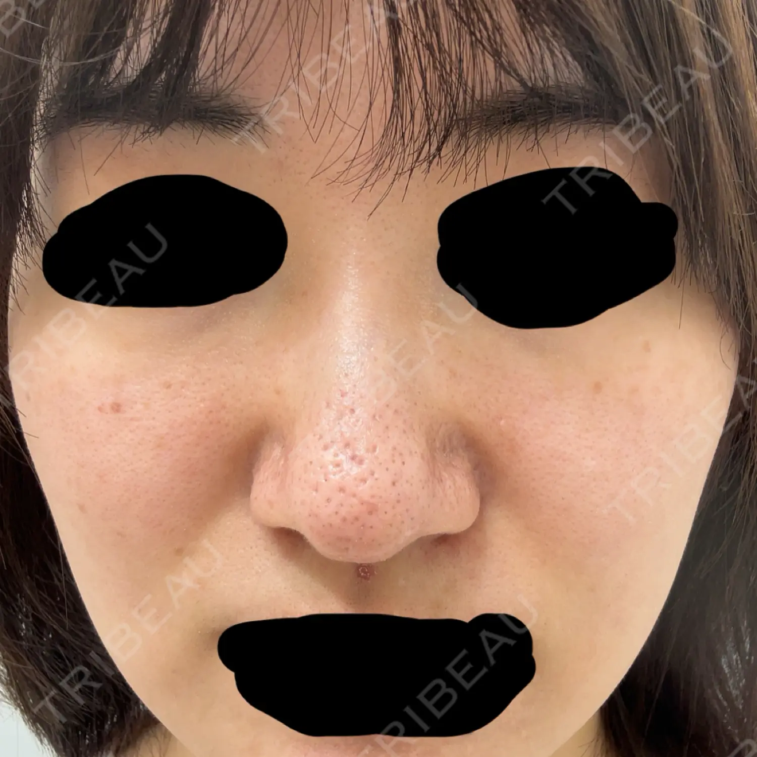 施術前の写真