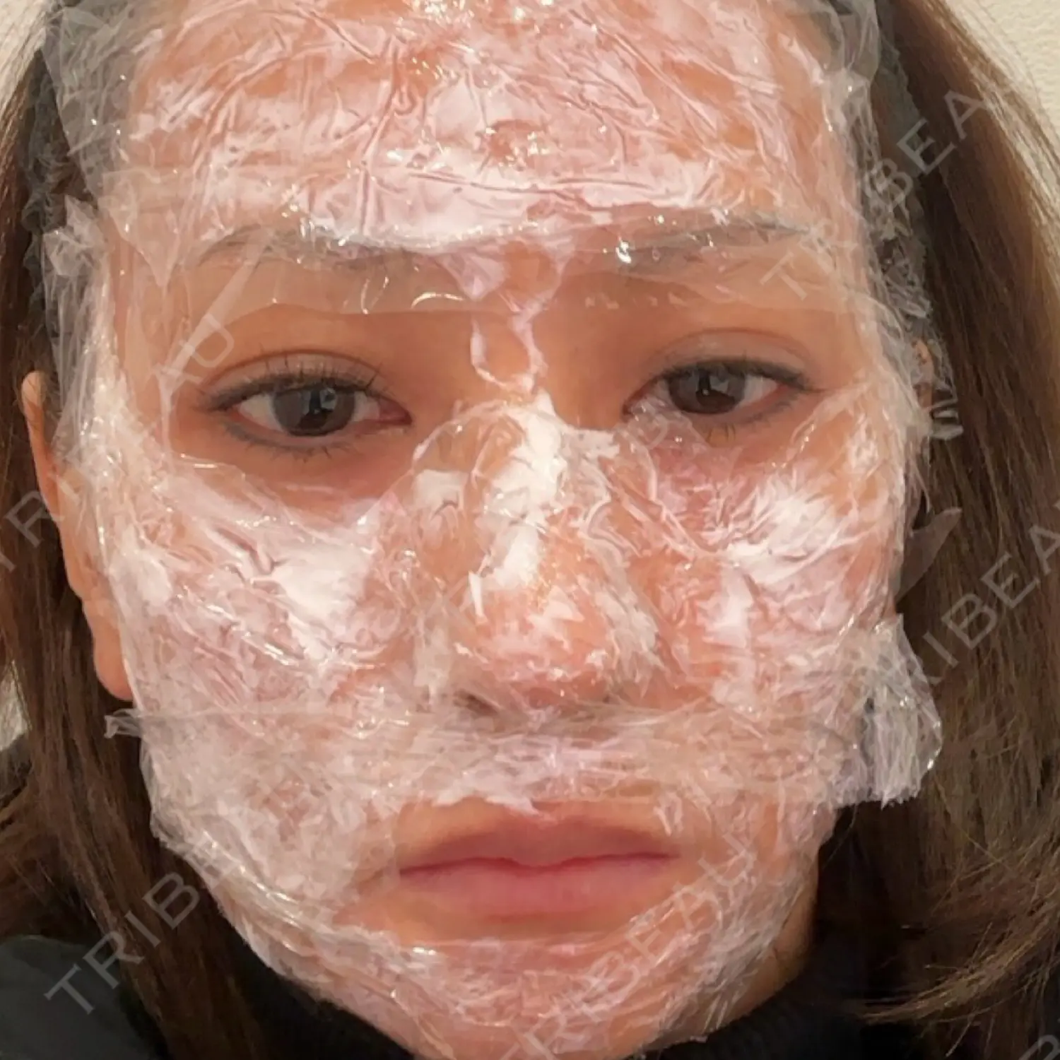 施術前の写真