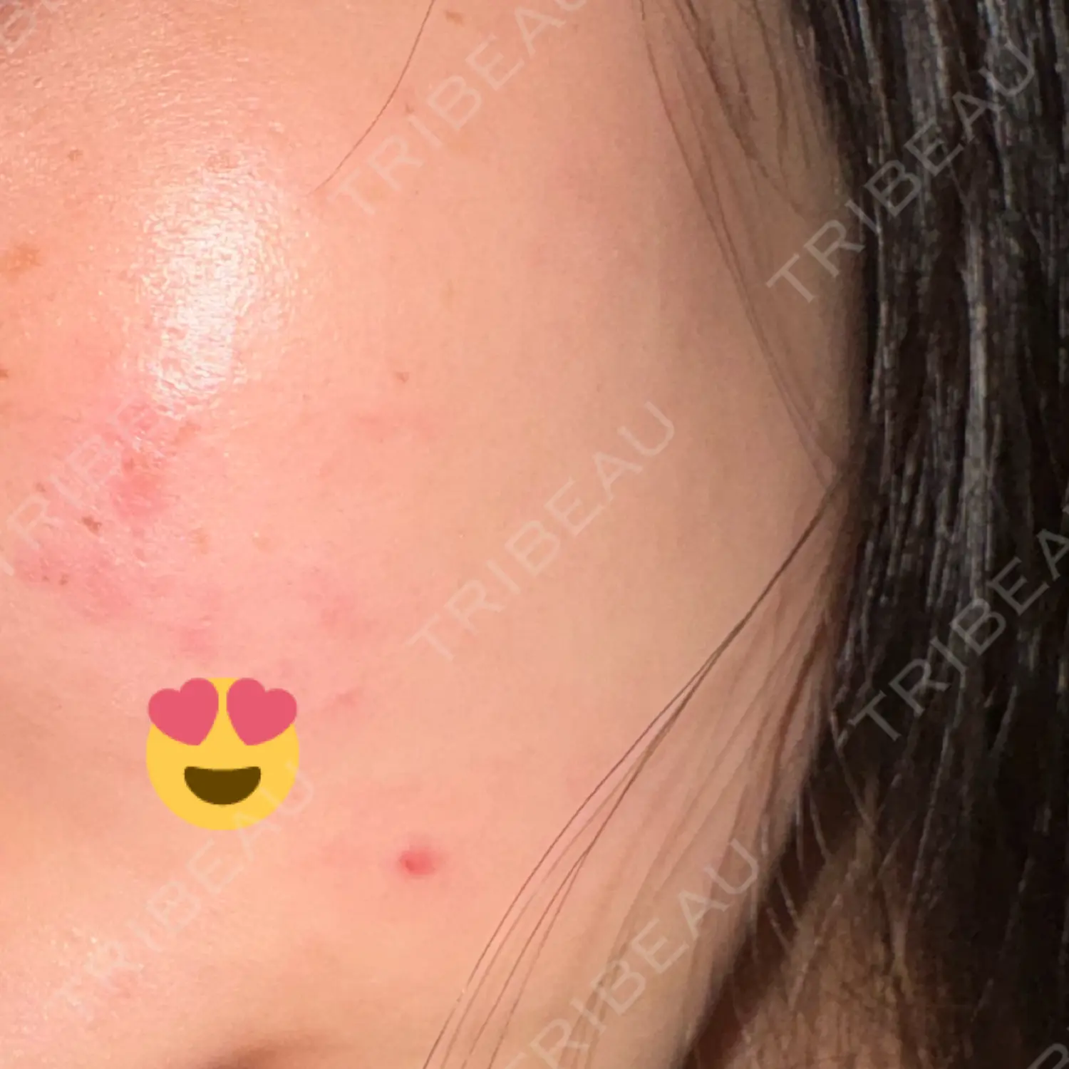 施術前の写真