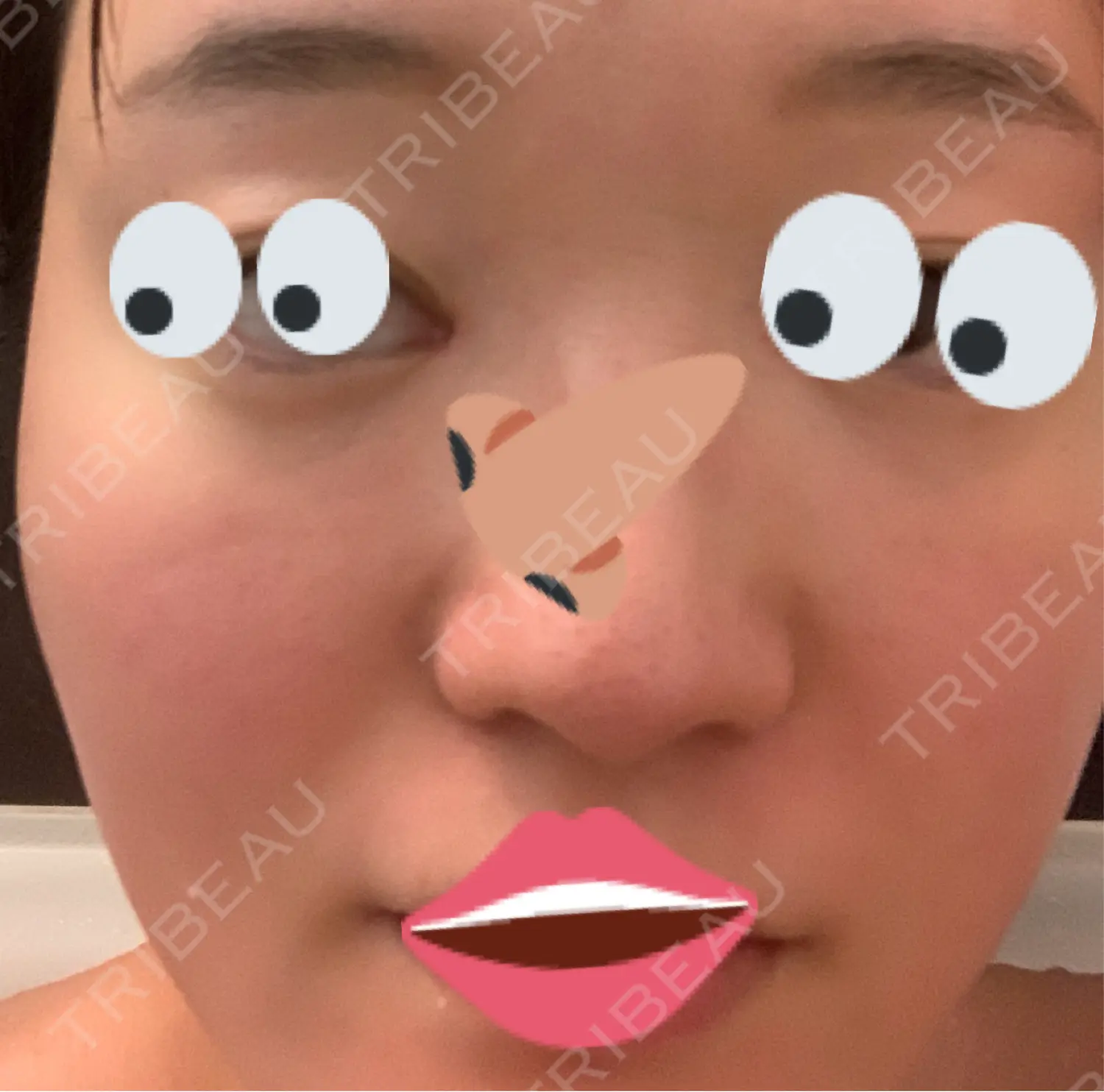 施術前の写真