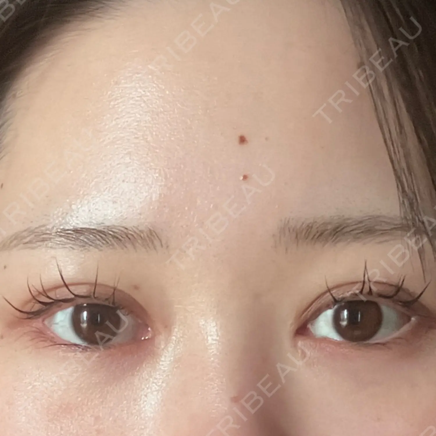 施術前の写真