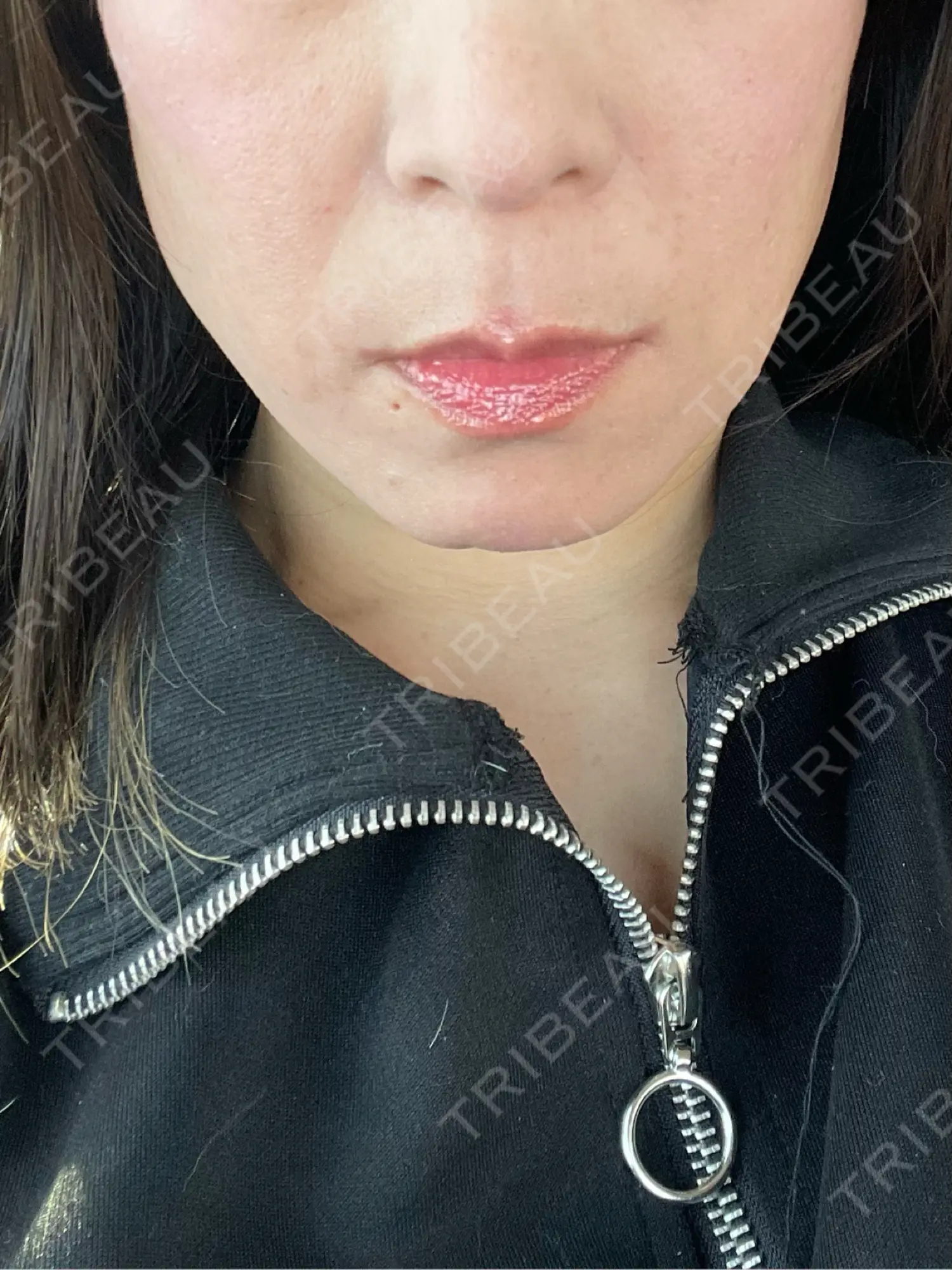 施術前の写真