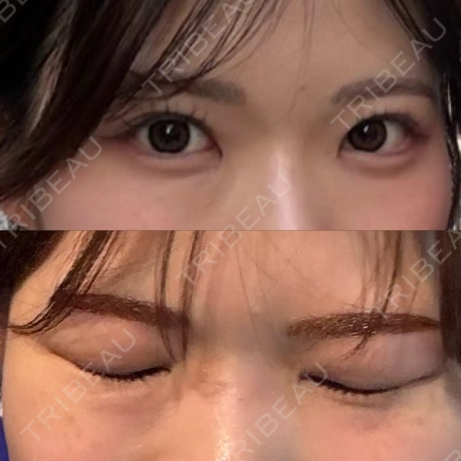 施術前の写真