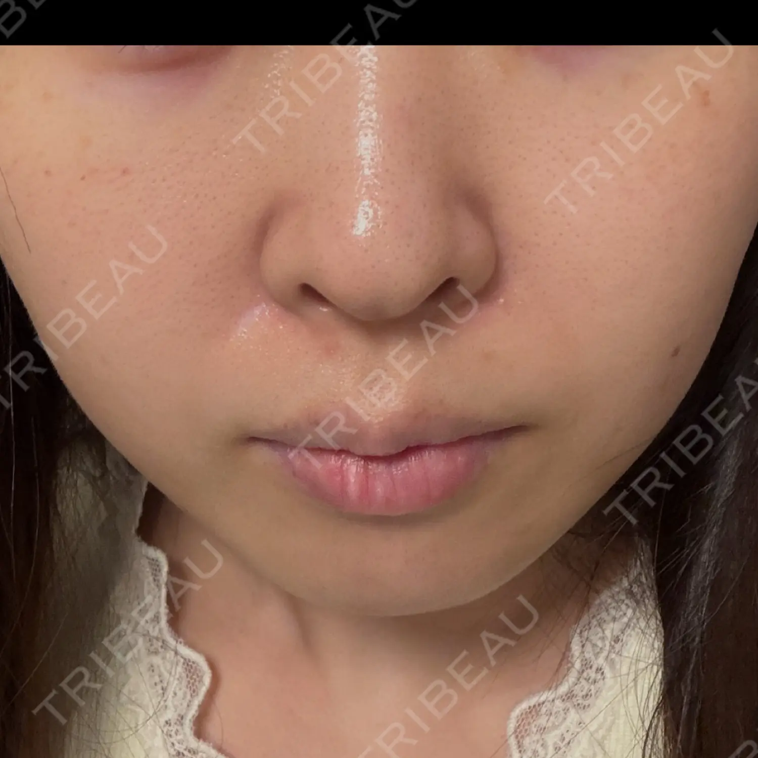 施術前の写真