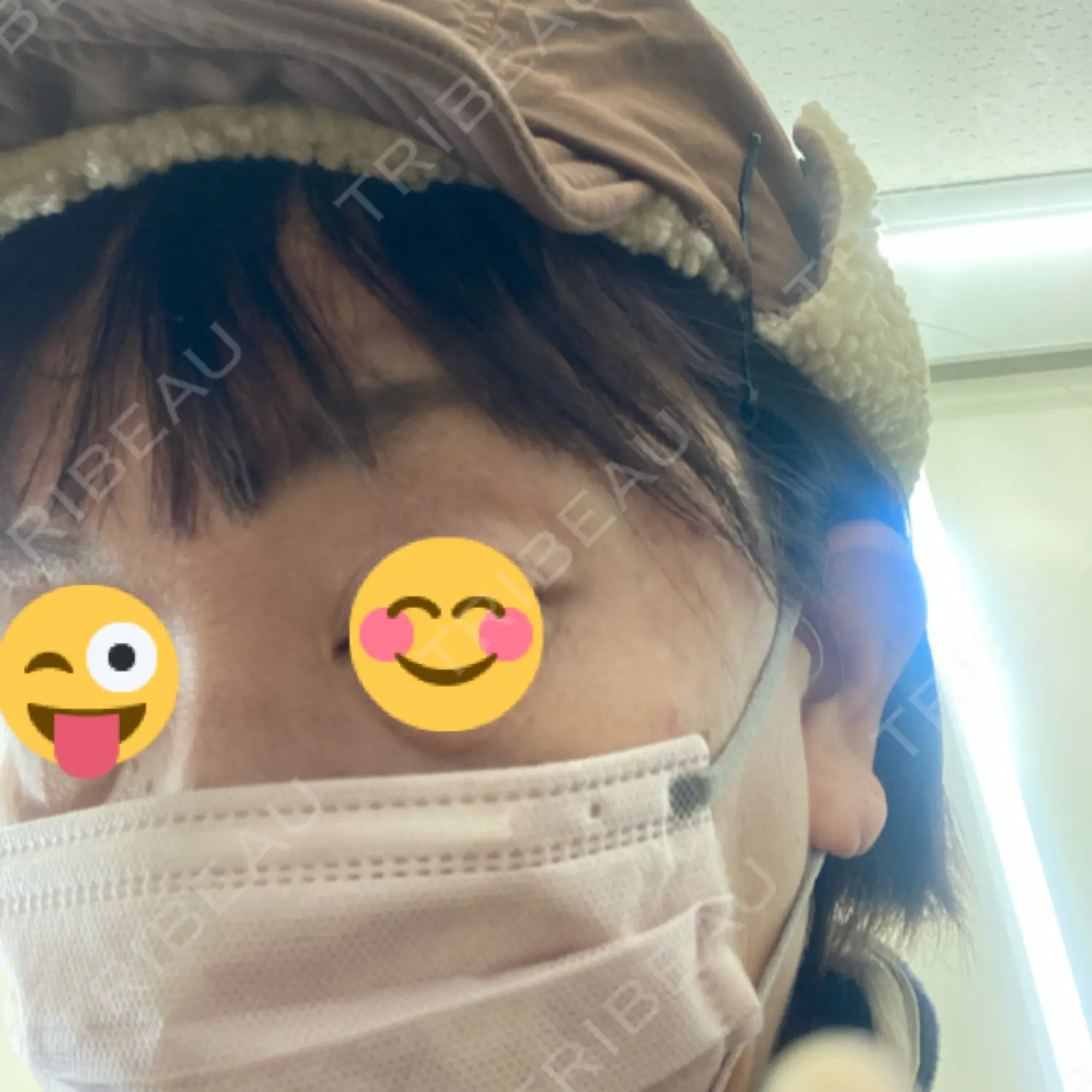 施術前の写真