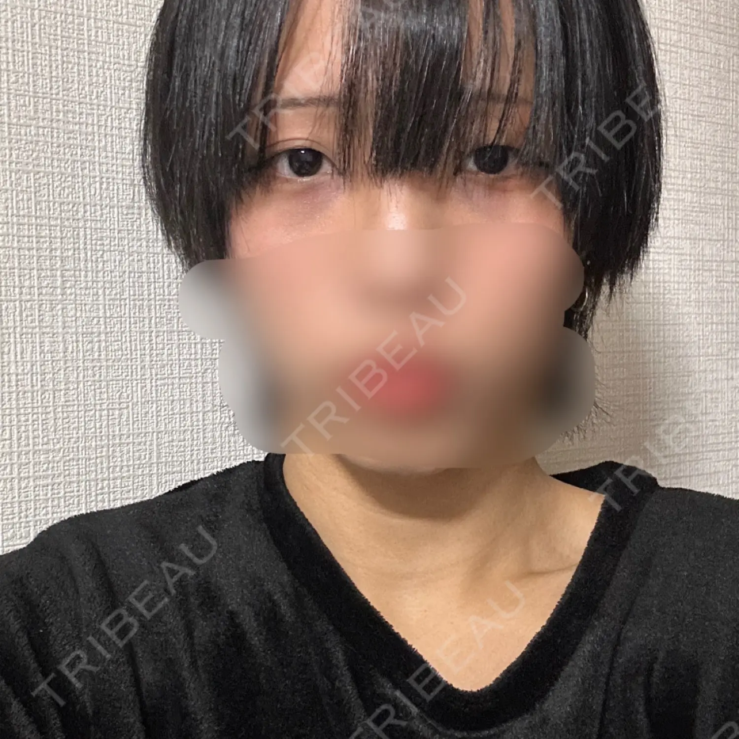 施術前の写真