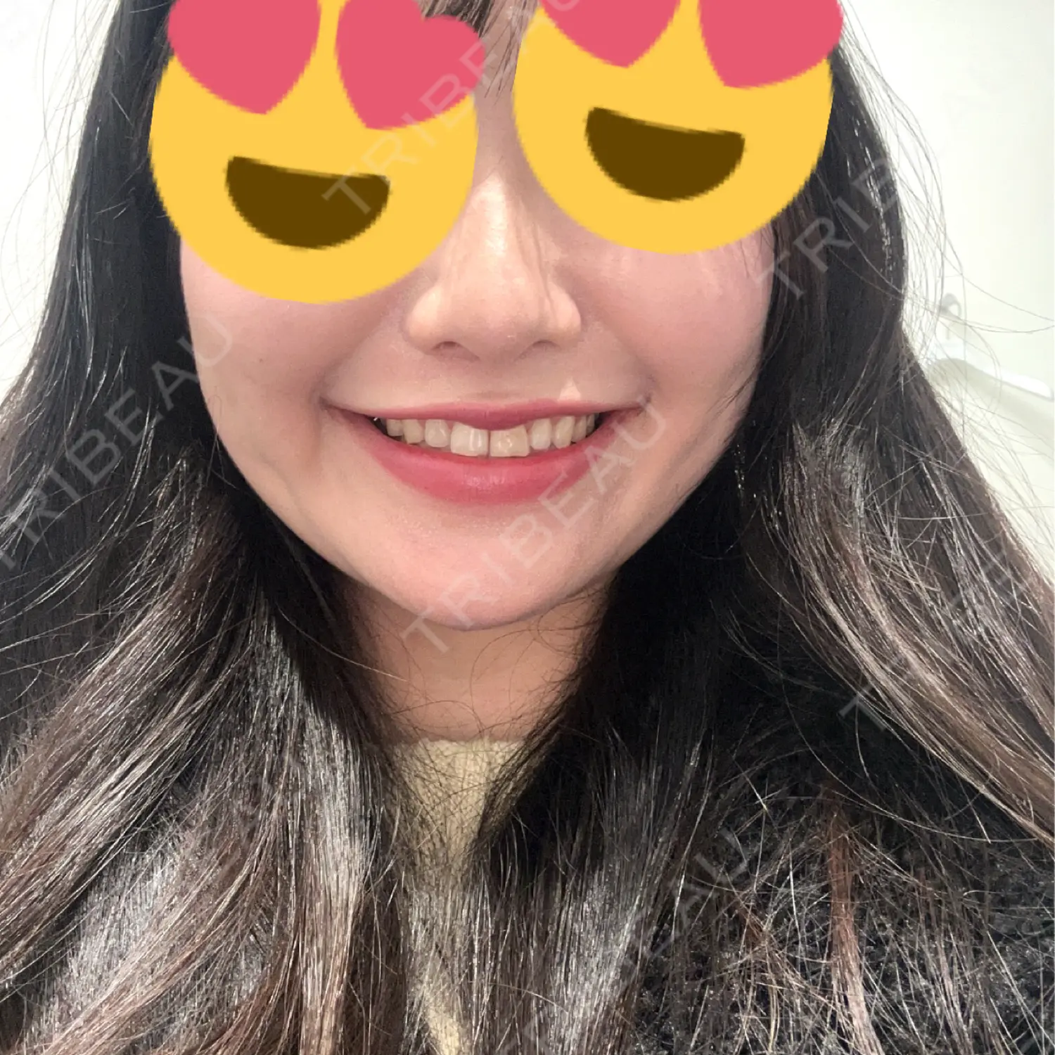 施術前の写真