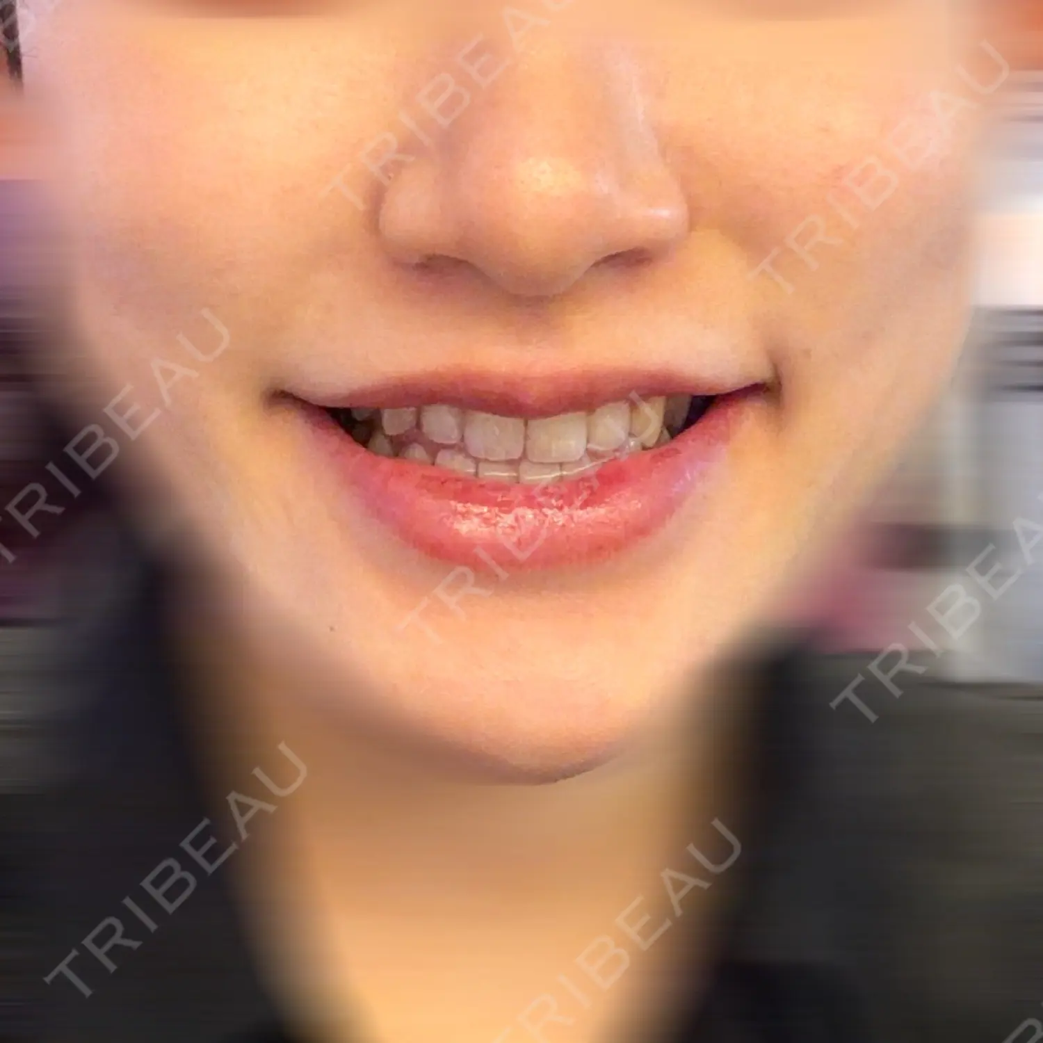 施術前の写真