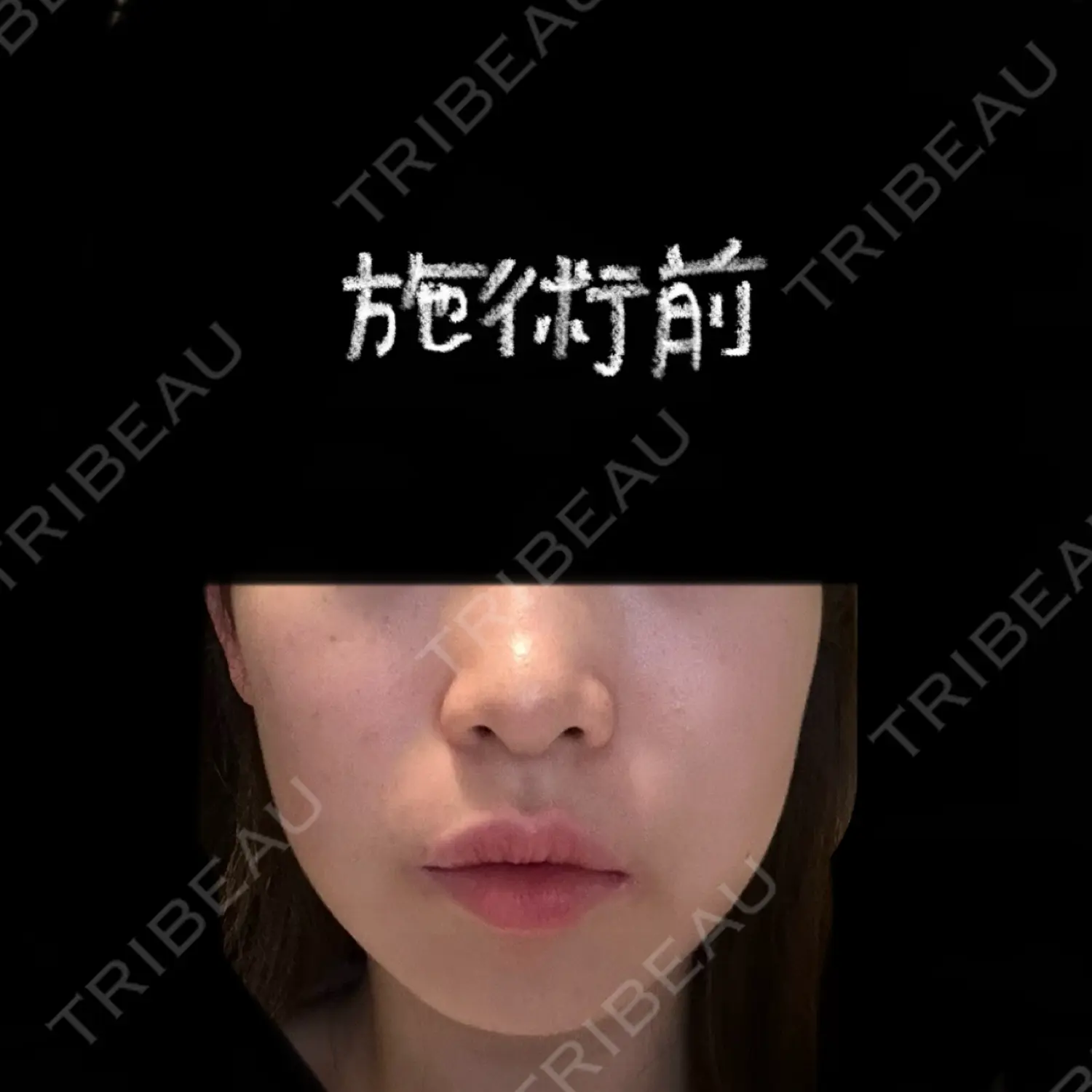 施術前の写真