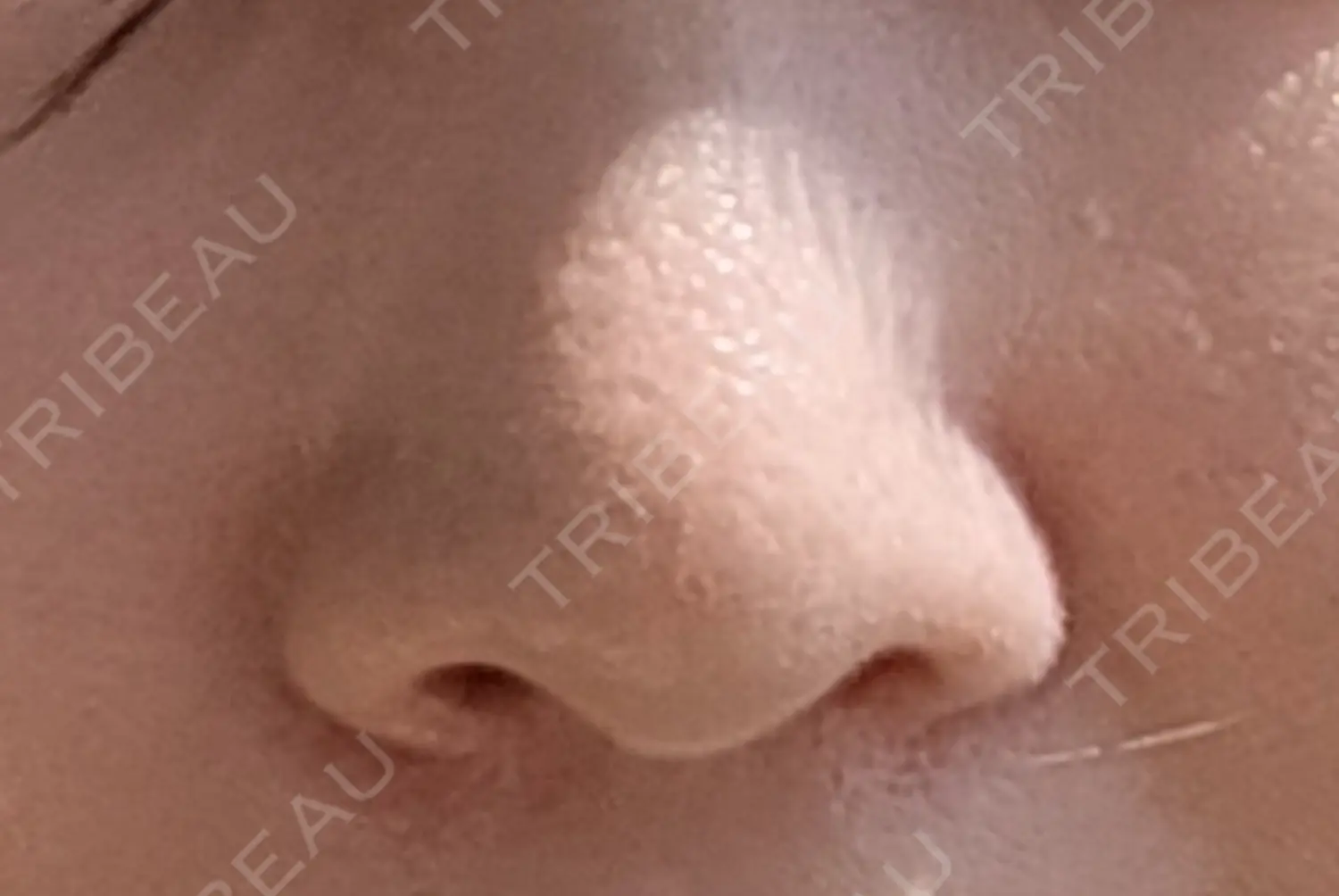 施術前の写真