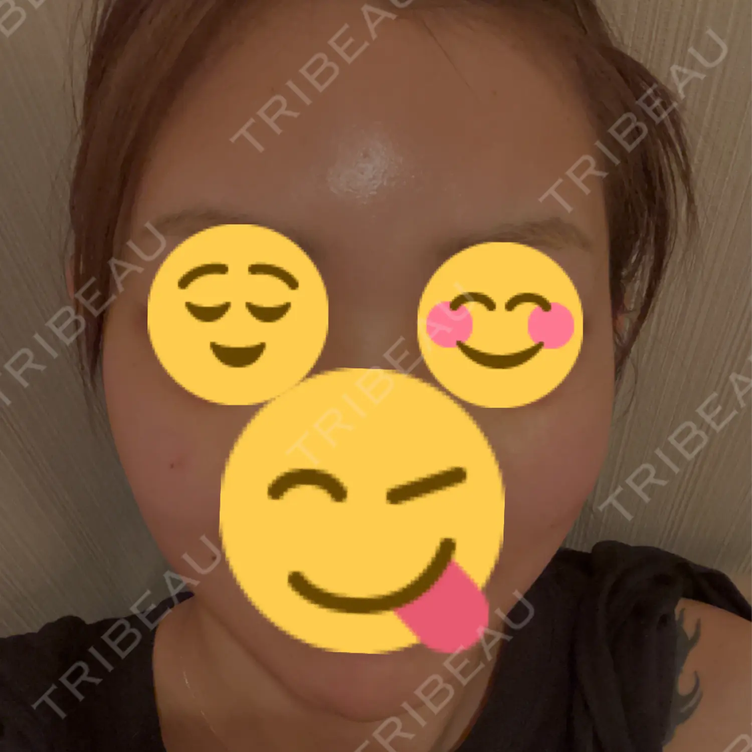 施術前の写真