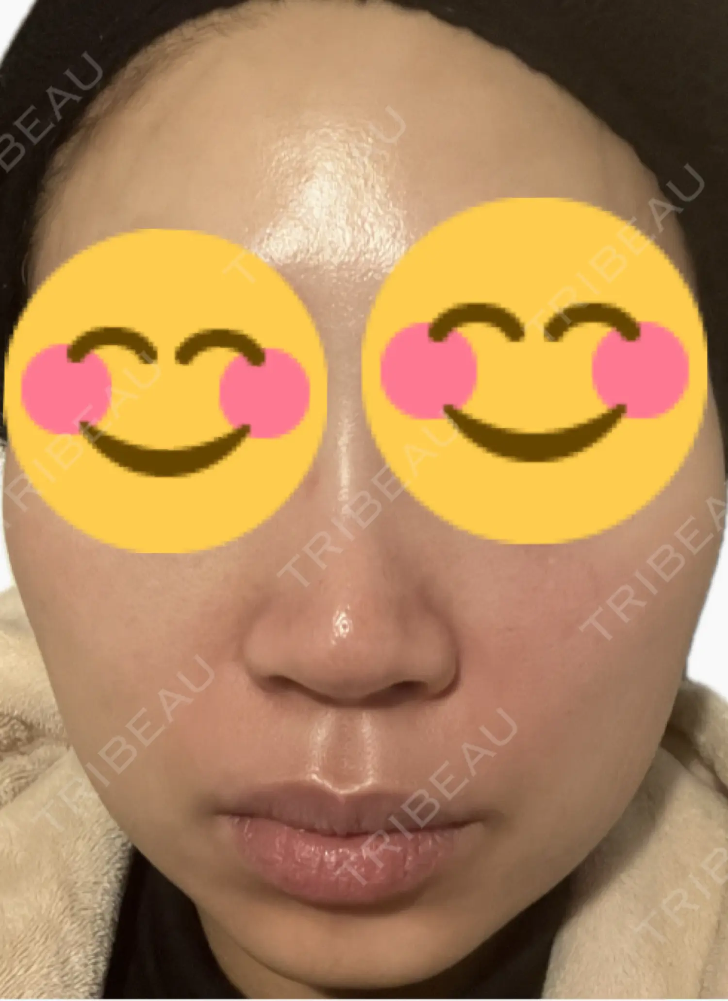 施術前の写真