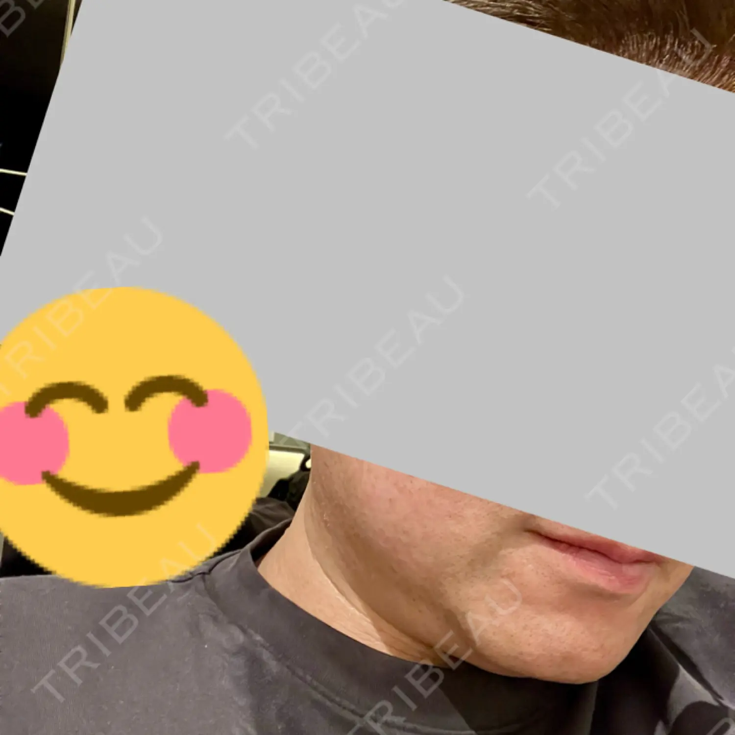 施術前の写真